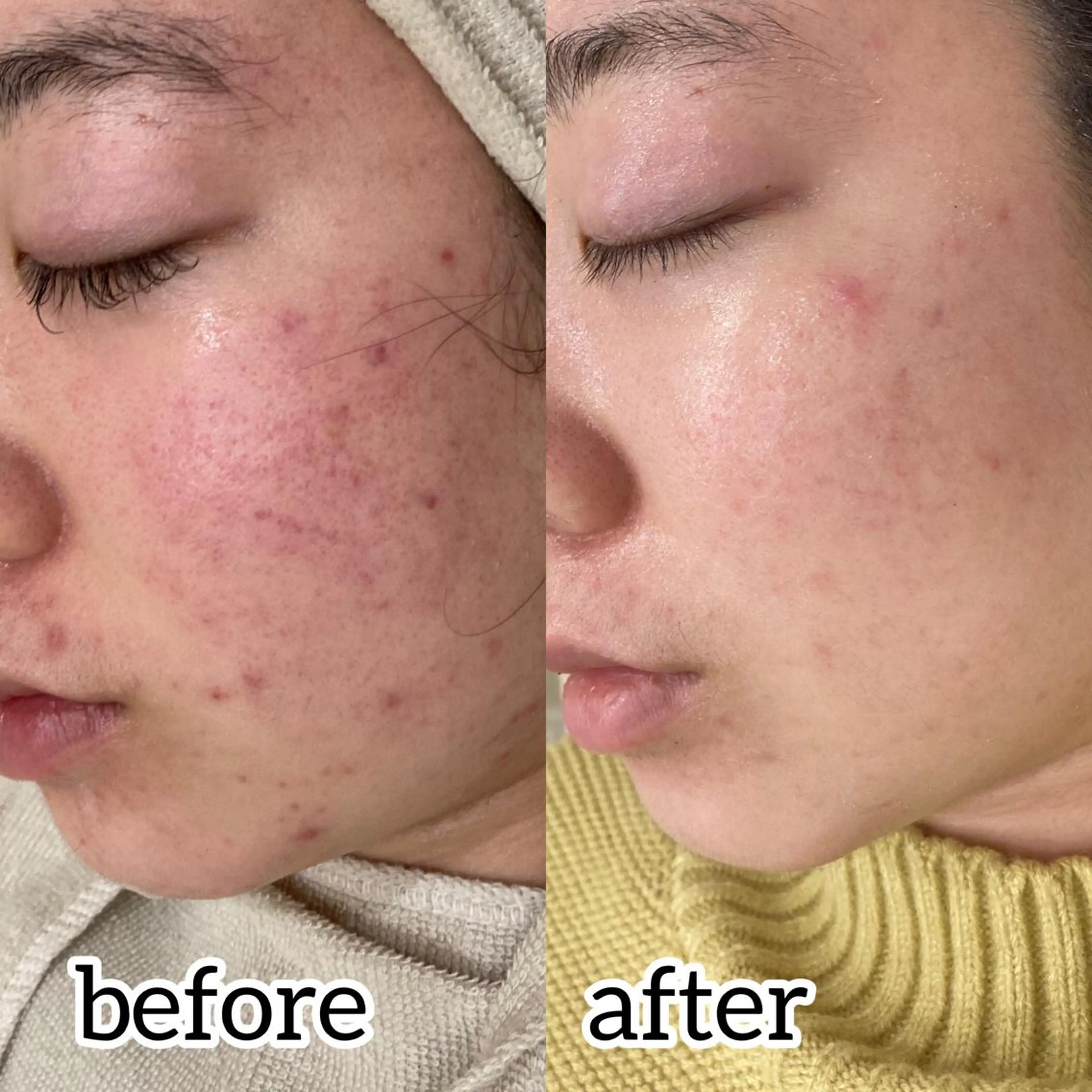 laluna saki...のその他イメージ