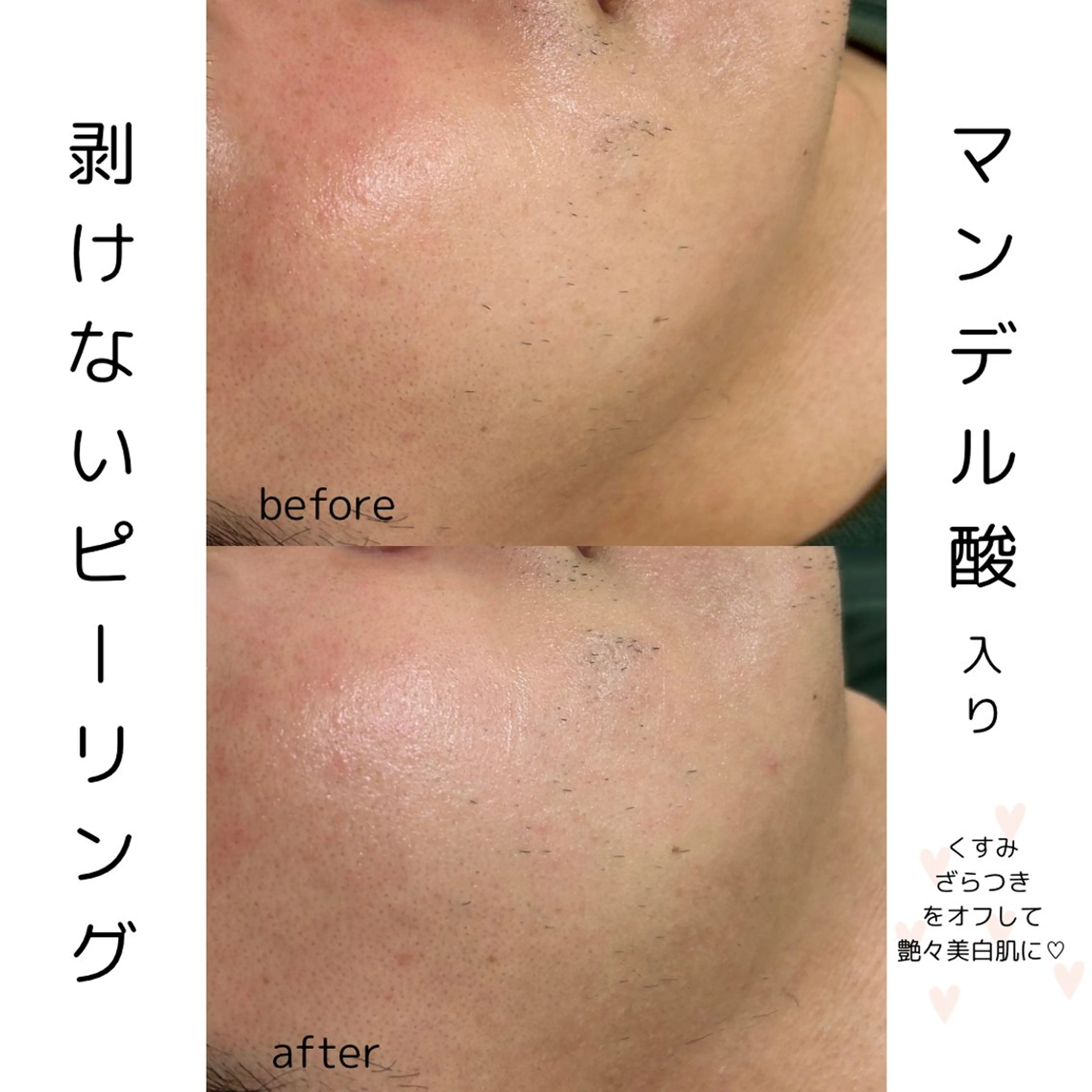 エステ 歌舞伎町深夜サロン to mëのエステ・リラクイメージ