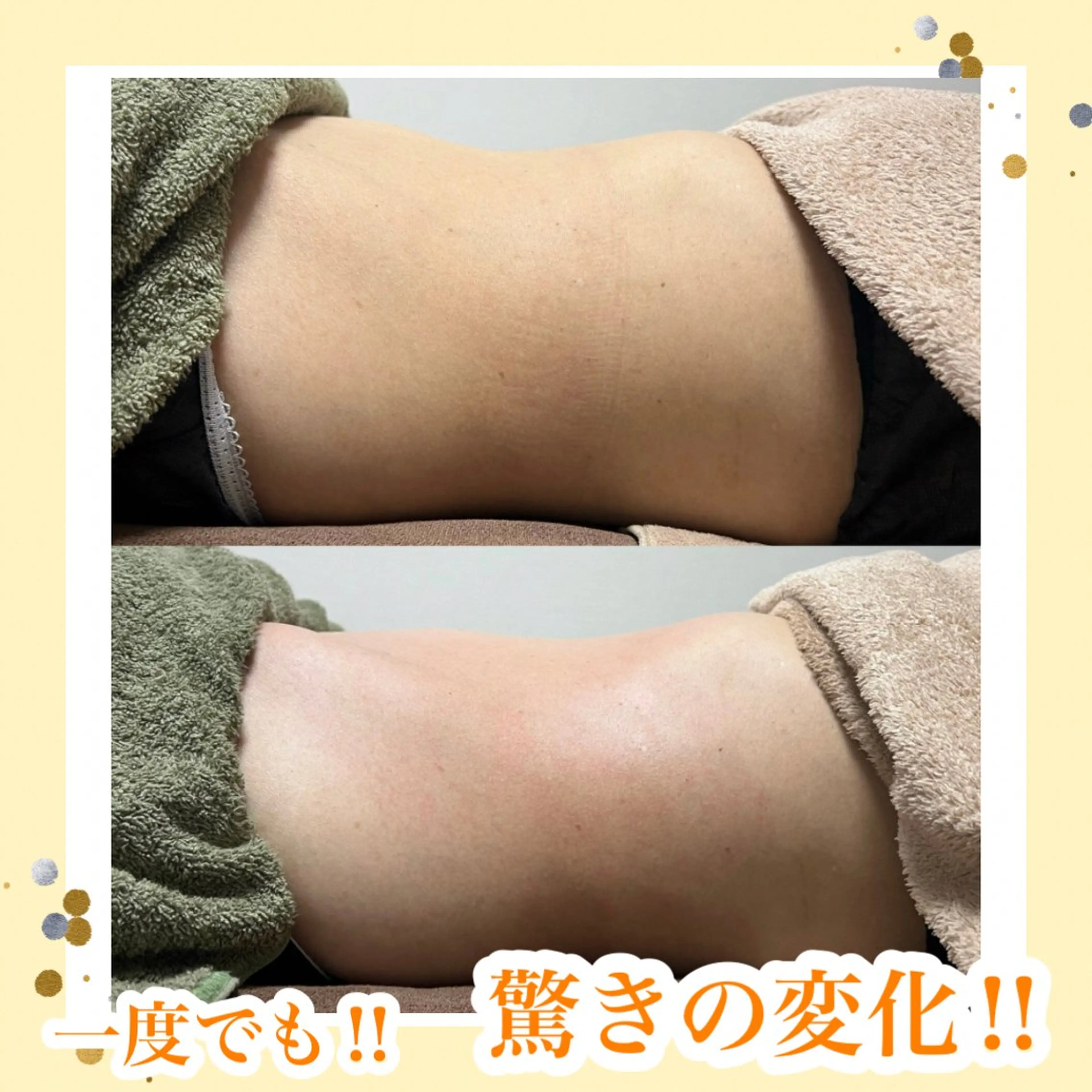 Beauty   Salon  Adiy所属・Adiy ikumiのエステ・リラクイメージ