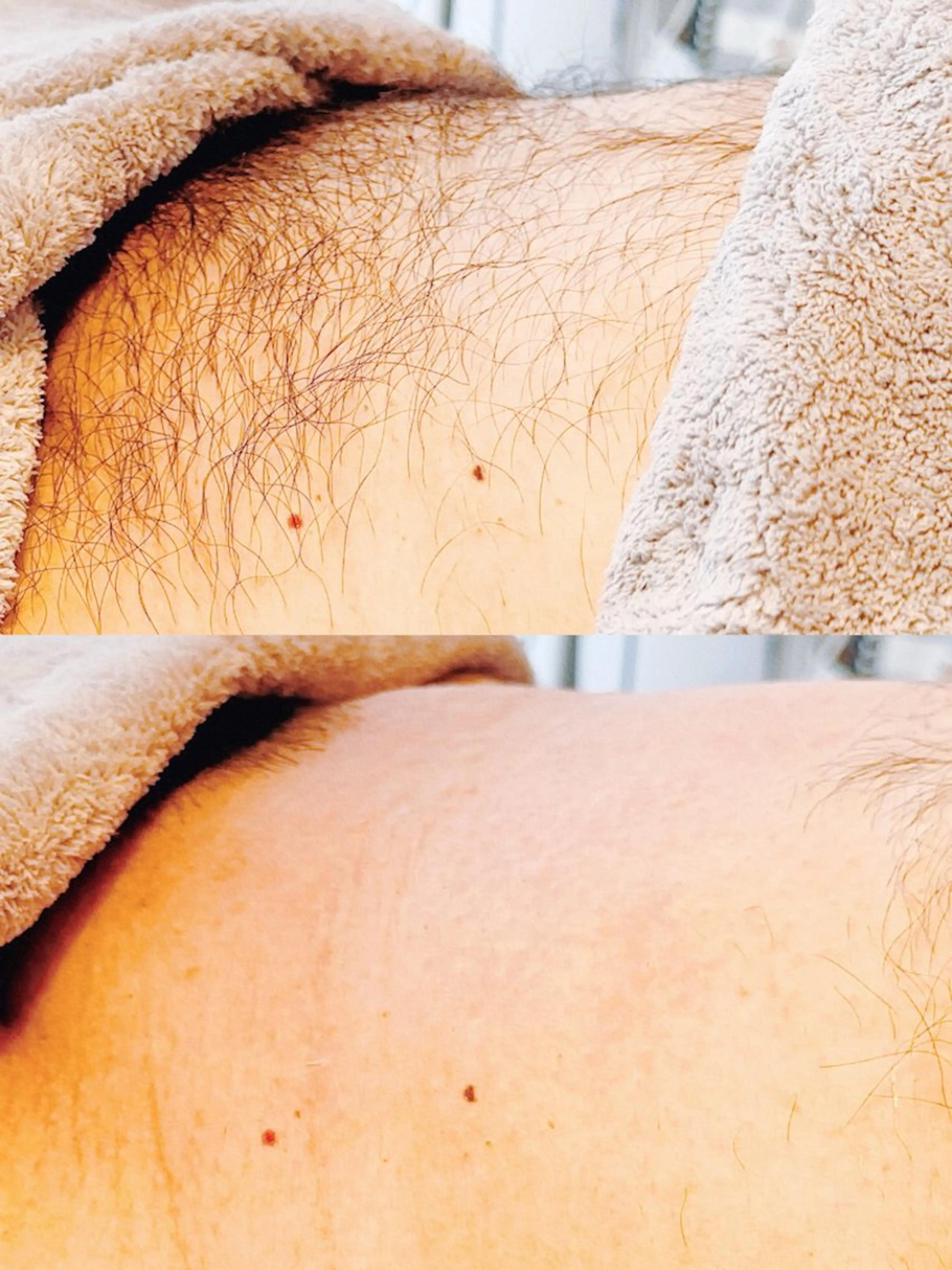 Hit. シュガーリング豊橋のエステ・リラクイメージ