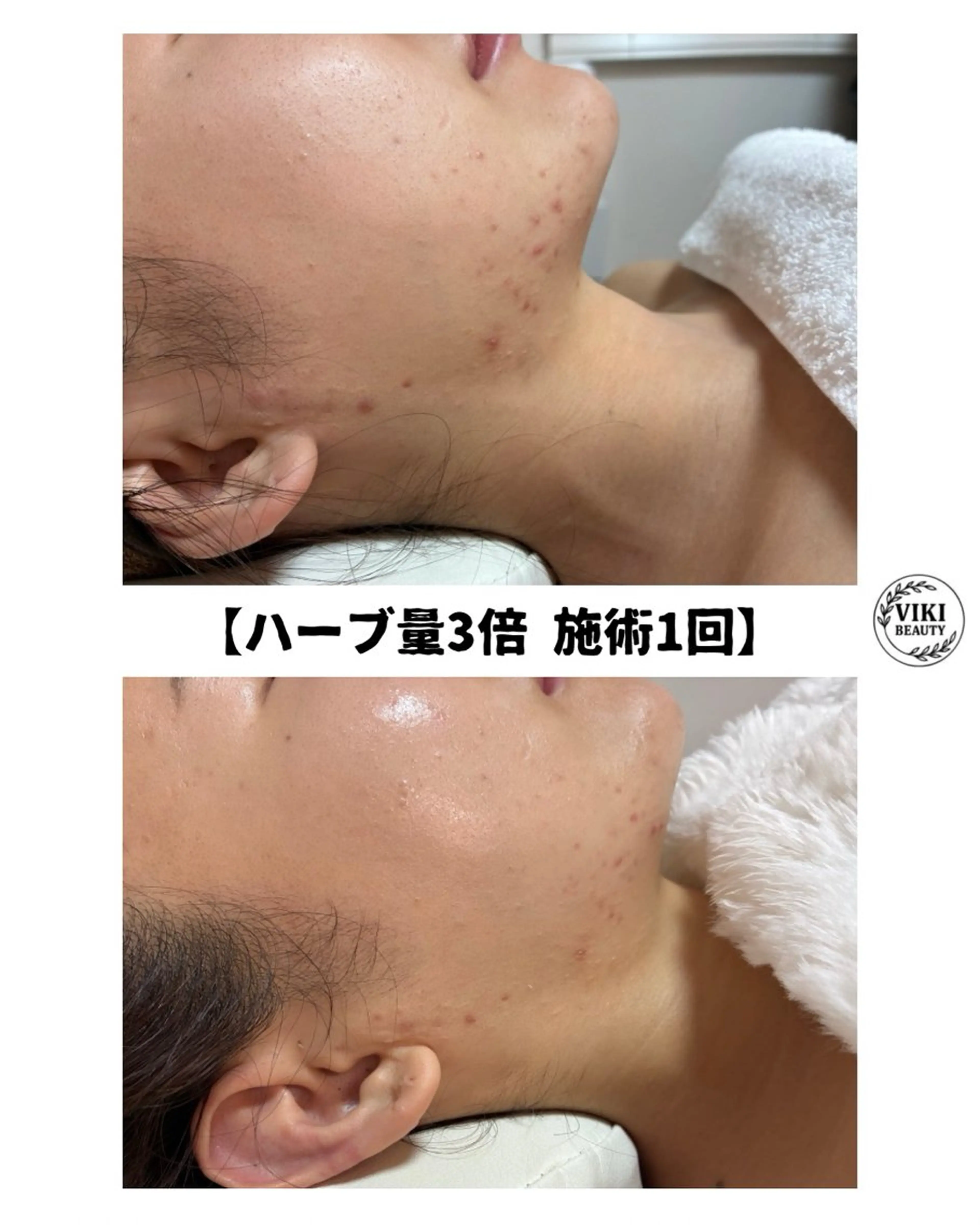 VIKI BEAUTY  クレイハーブピーリング・美肌脱毛専門店所属・VIKI BEAUTYのエステ・リラクイメージ