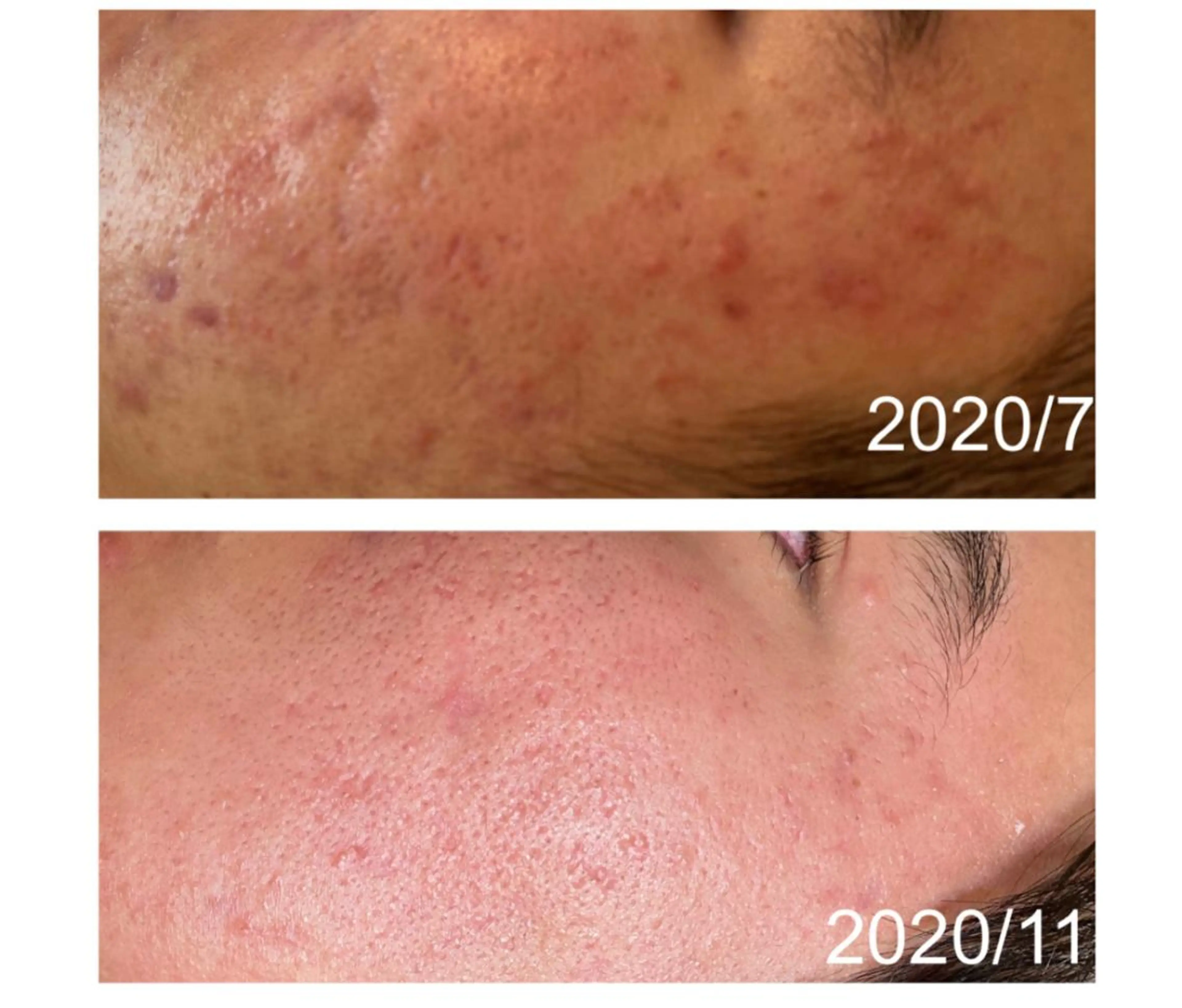 ニキビ改善サロン　縁樹　enju所属・ニキビ専門サロン縁樹 鈴木真樹のエステ・リラクイメージ