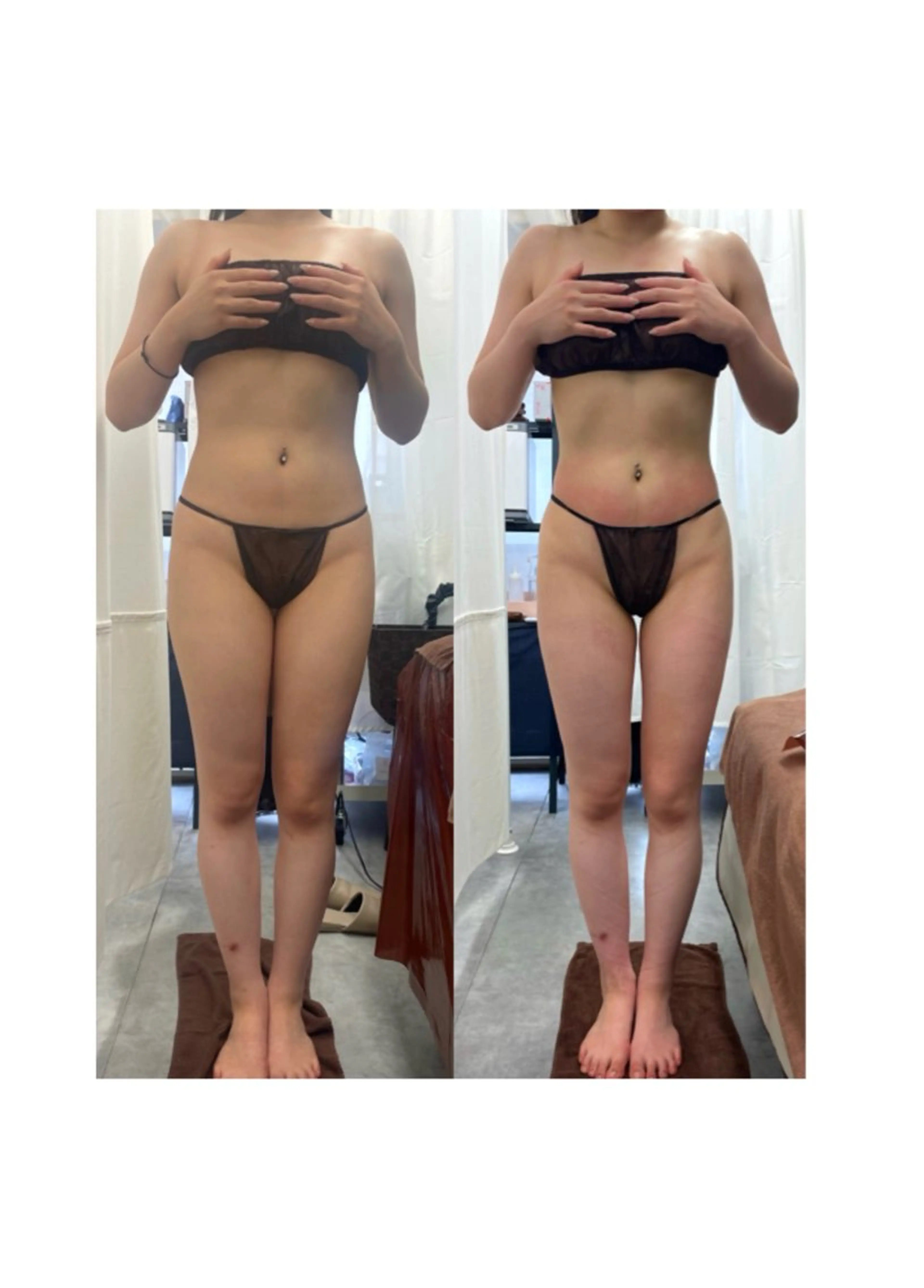 エステ リラク espresso,所属・《痩身、小顔専門店》 エスプレッソのエステ・リラクイメージ