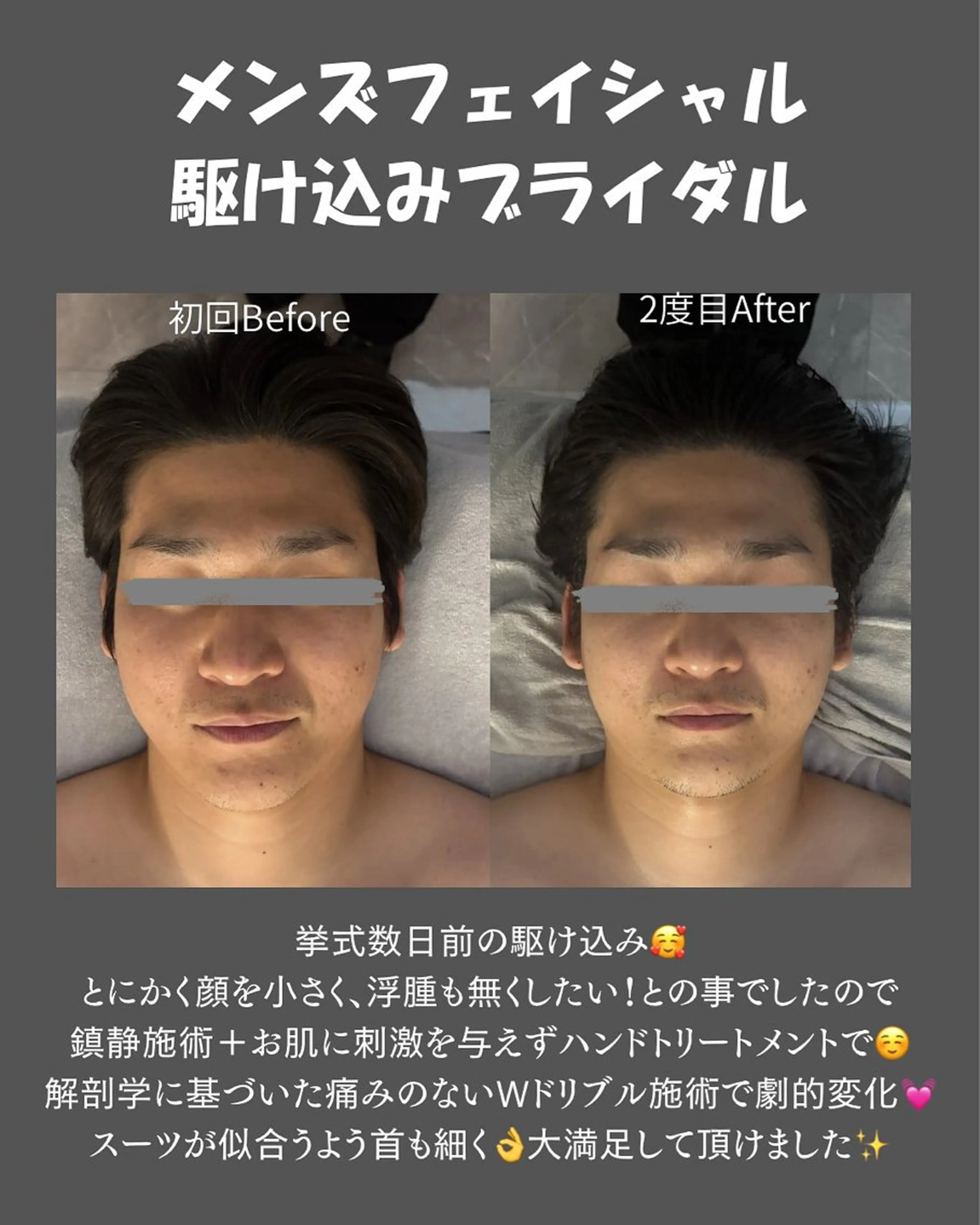 エステ BLOSSOM 菊地のエステ・リラクイメージ