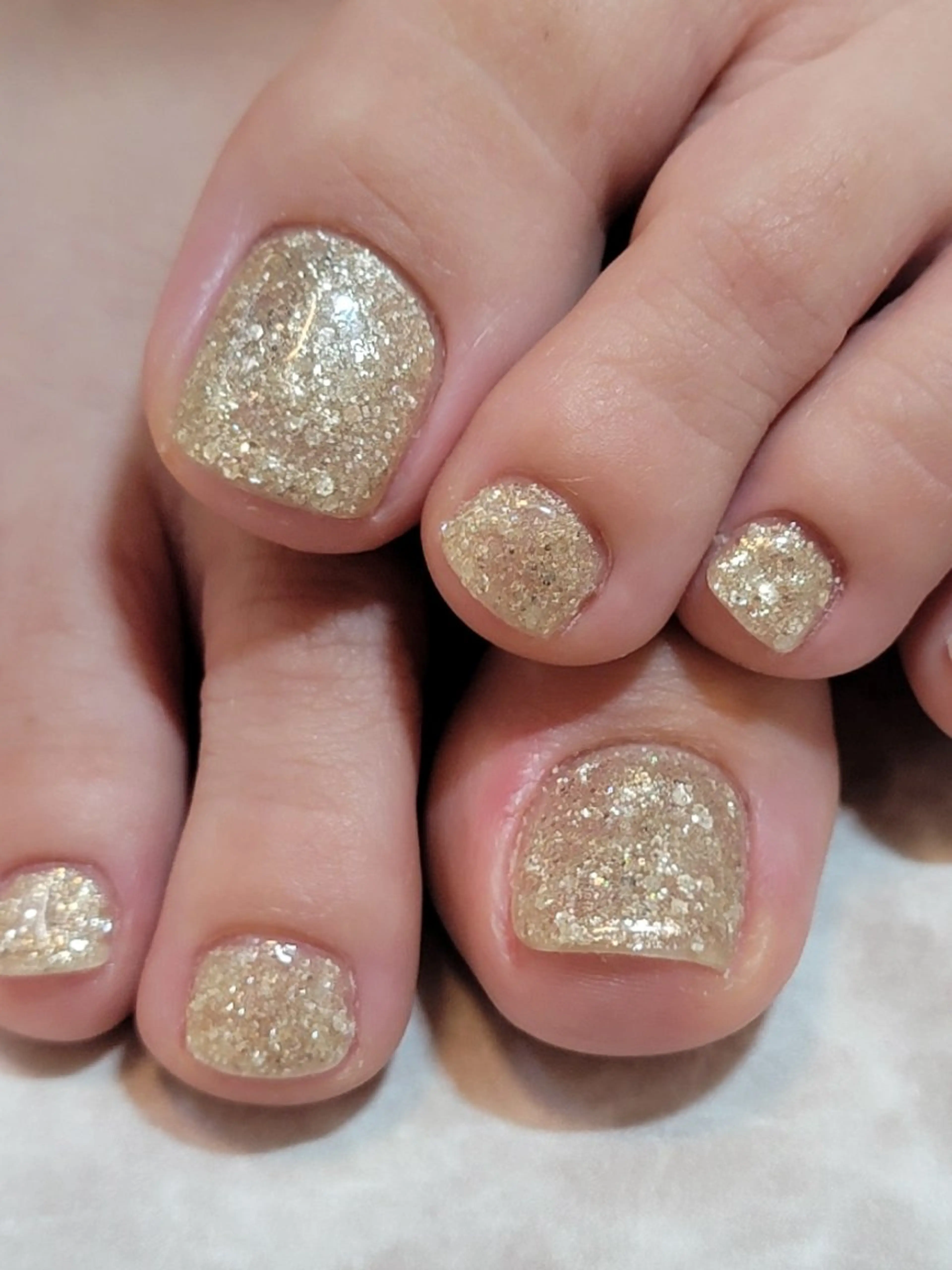 ネイル フットネイル ネイル&巻き爪サロン 　AKnailのネイルデザイン