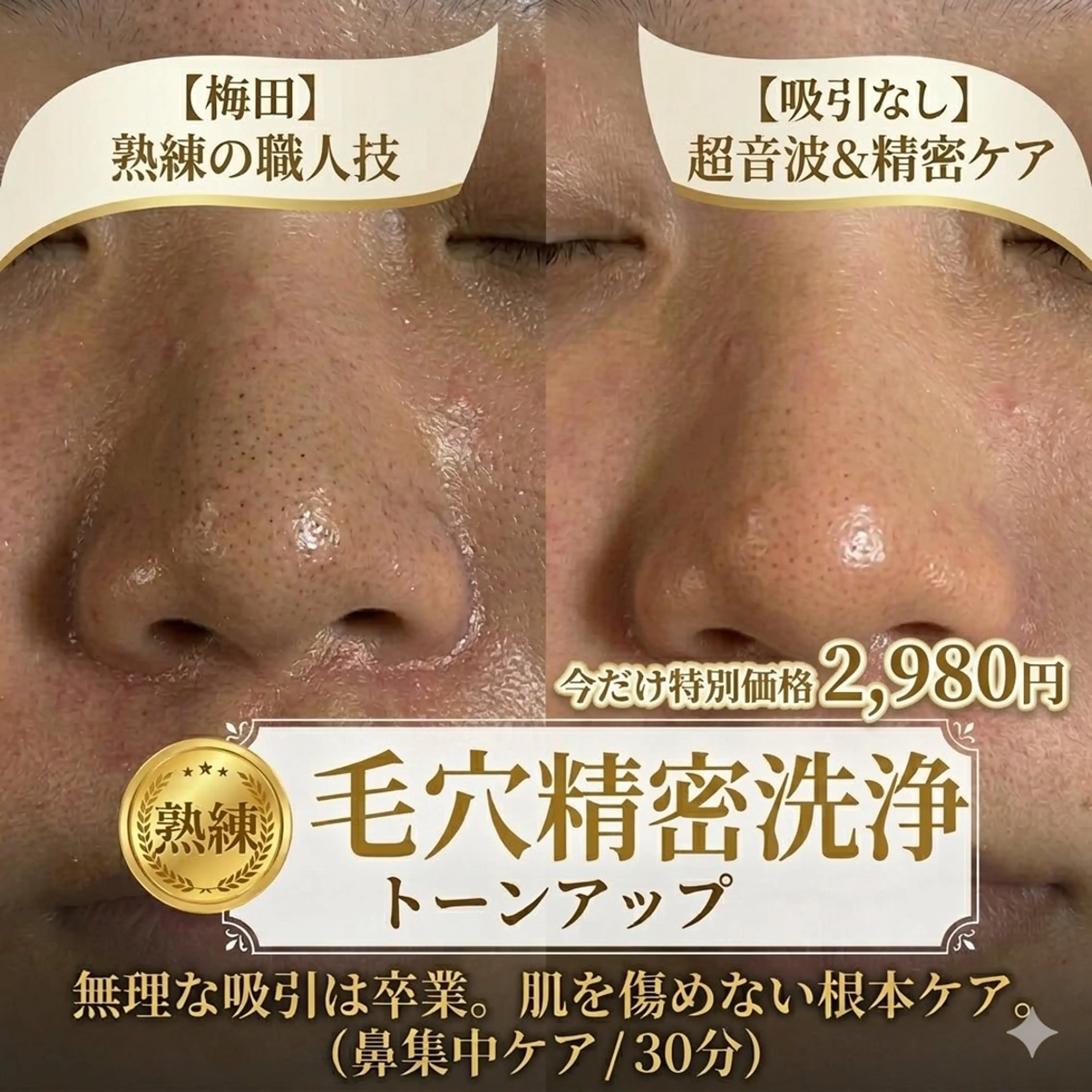 【肌質改善 毛穴洗浄】無理な吸引は卒業✨ベテランの超音波＆精密ケア ¥2,980（大阪 梅田）の写真