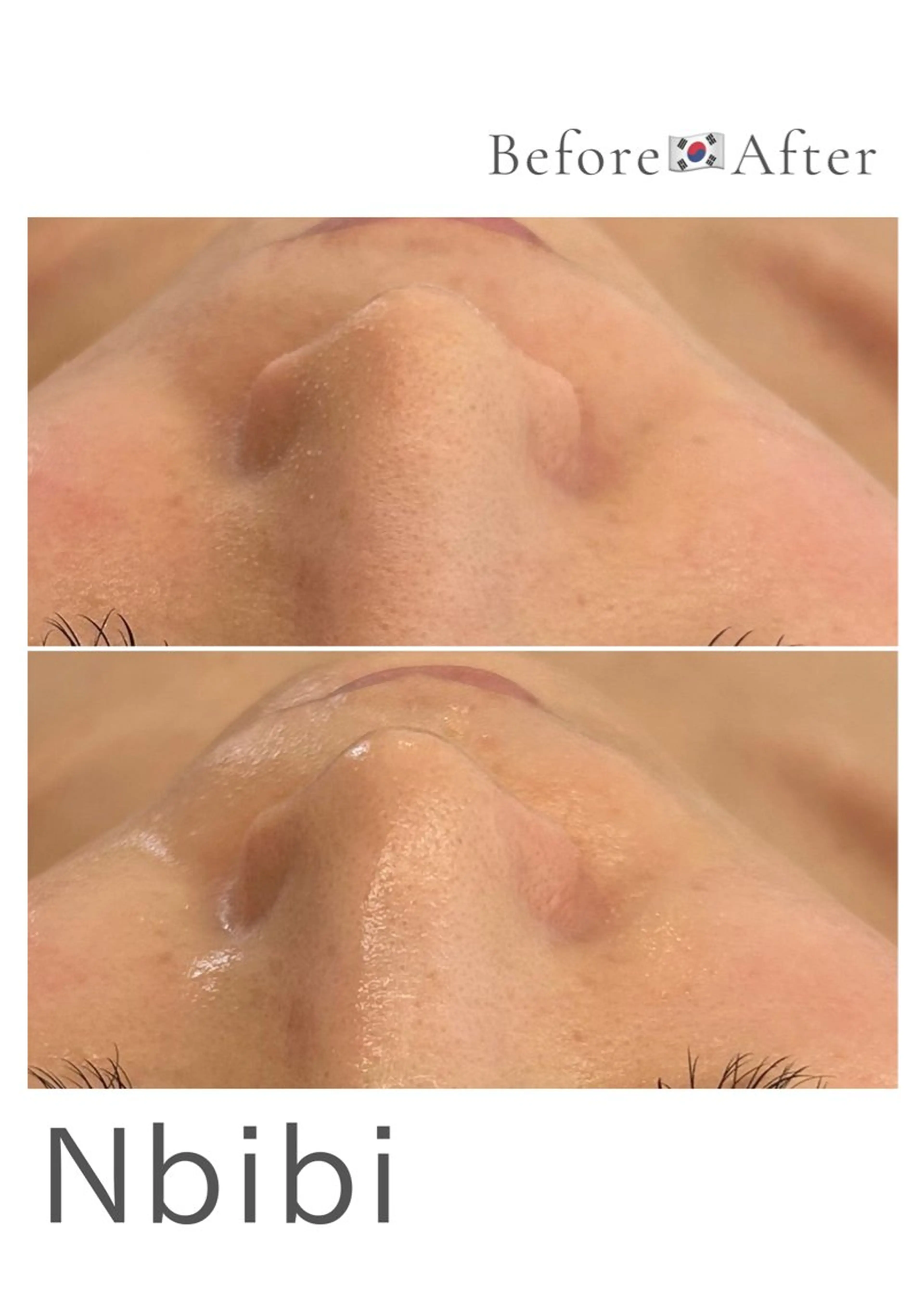 韓国🇰🇷価格 サロン_Nbibiのエステ・リラクイメージ