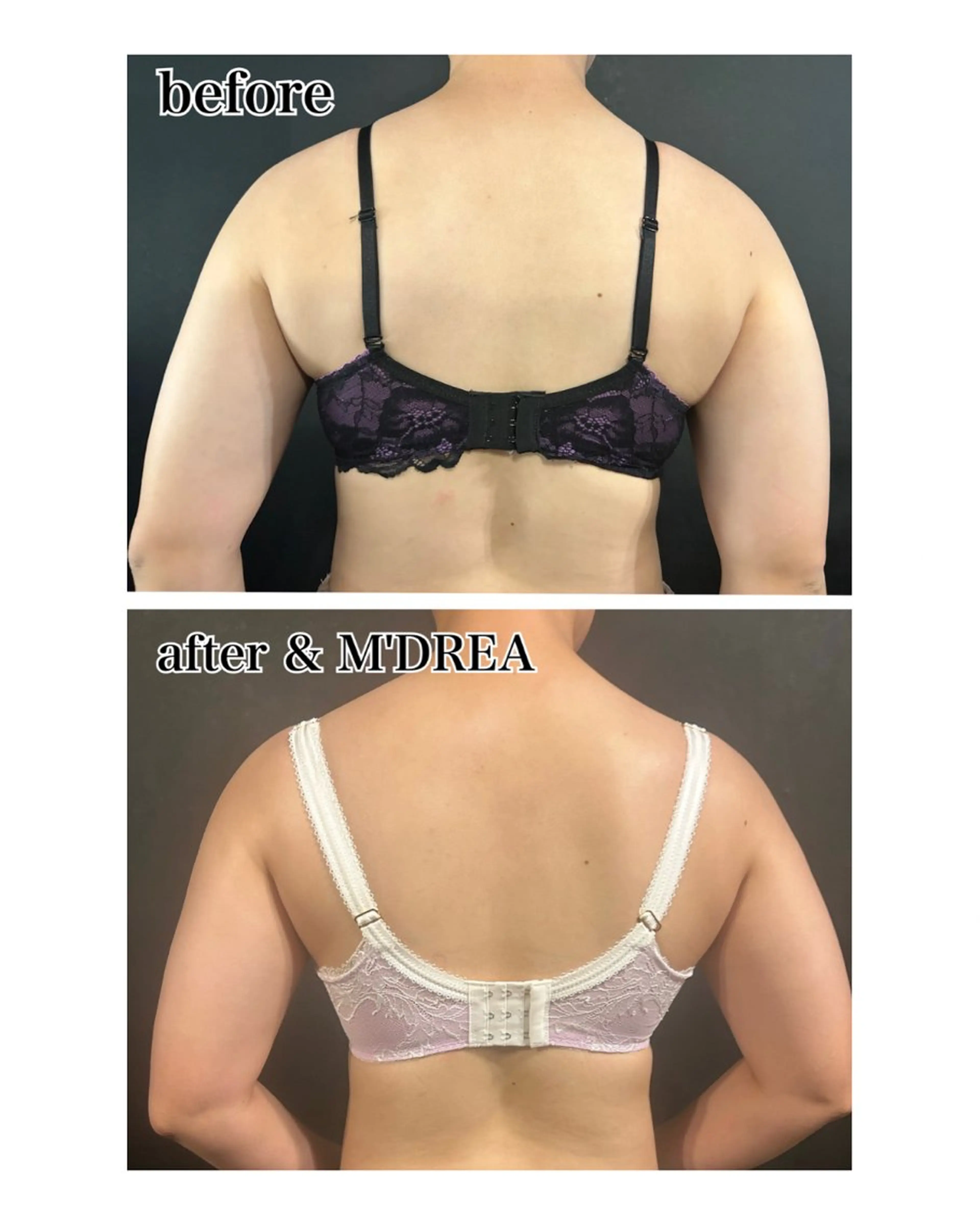 エステ Gemini 　MIKIのエステ・リラクイメージ