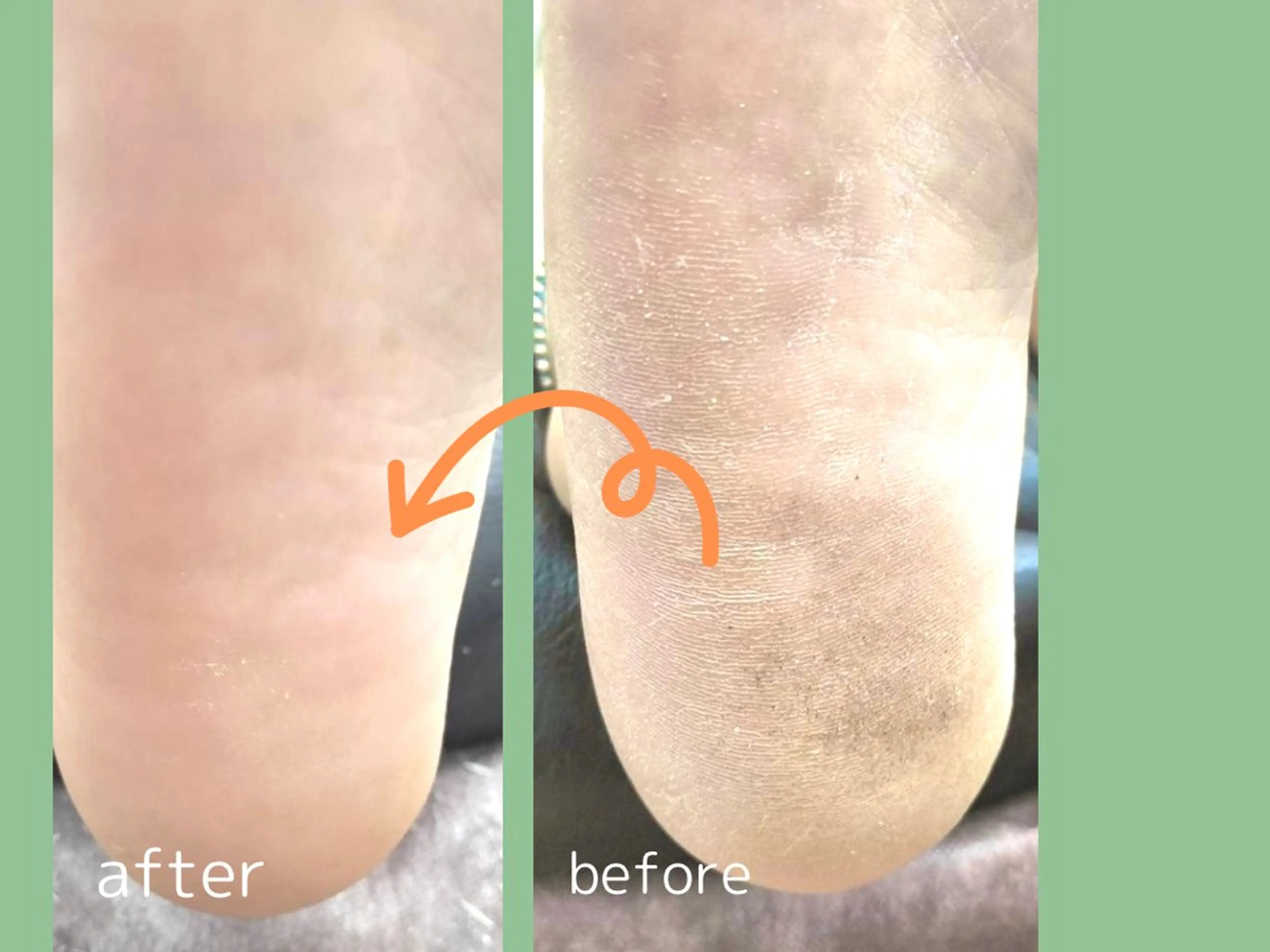 blanca🌺 mayu(東白楽)のマツエク・マツパデザイン