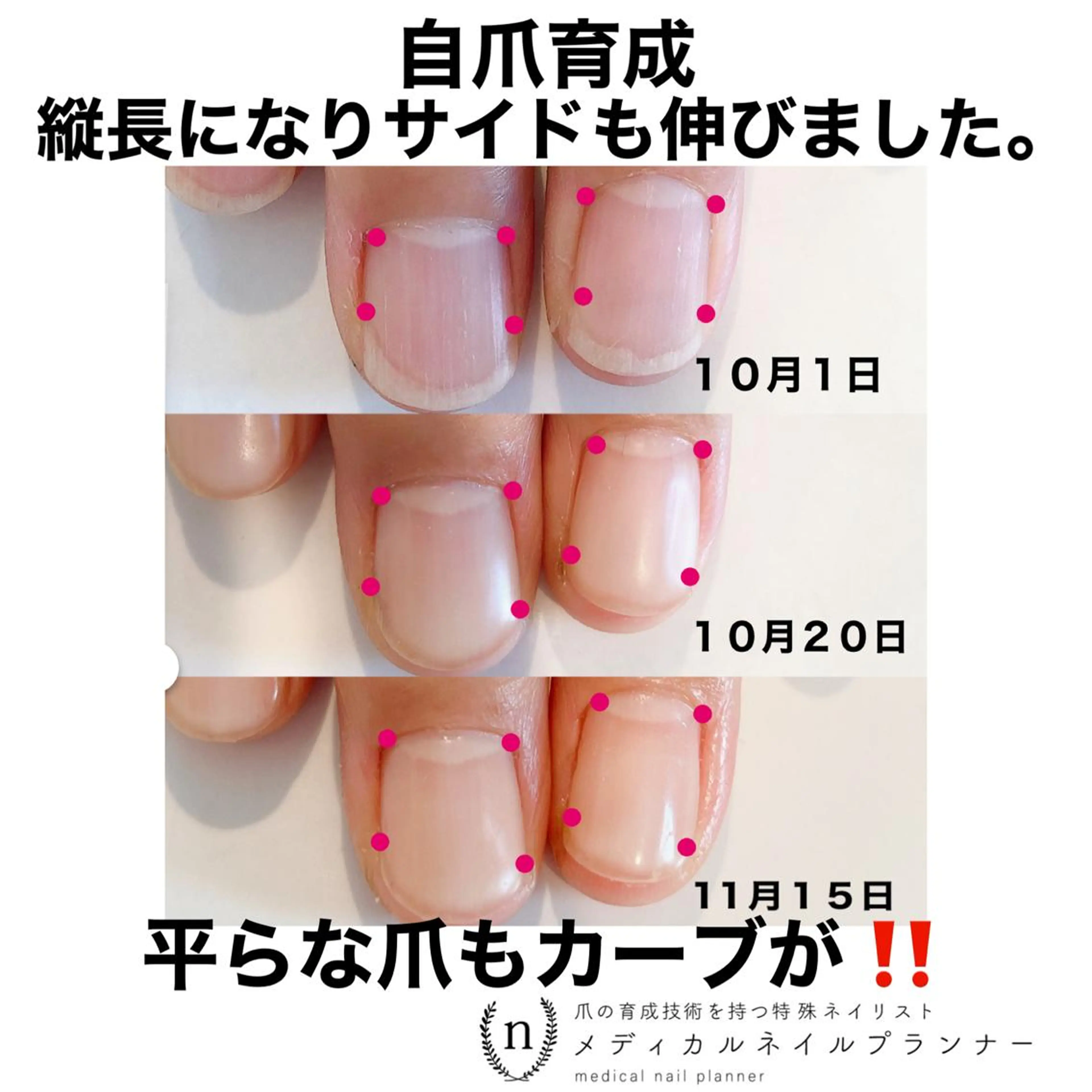 ネイル NAIL SALON ｔｏｇｇｙのネイルデザイン