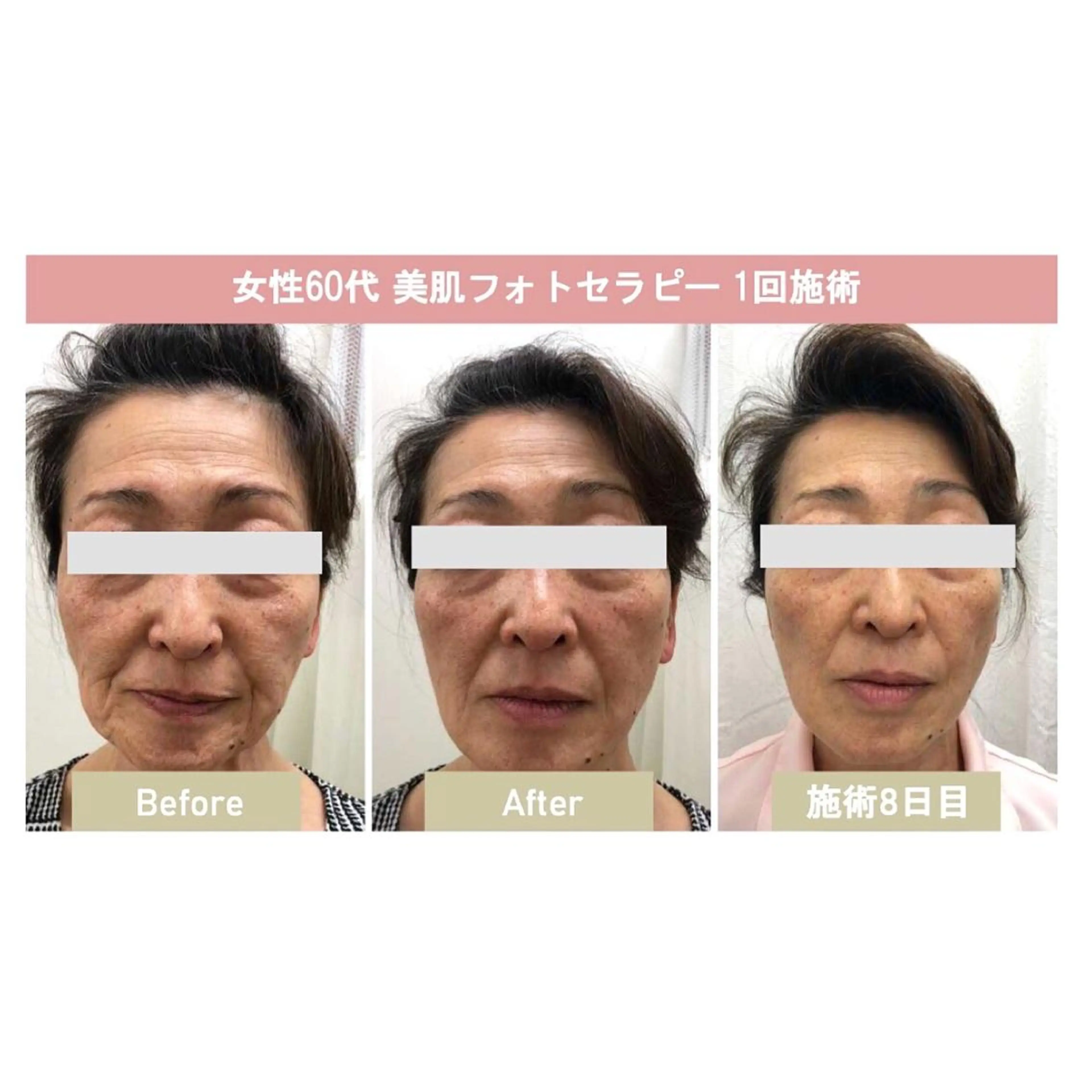 美肌脱毛i所属・美肌脱毛i |泉大津のエステ・リラクイメージ