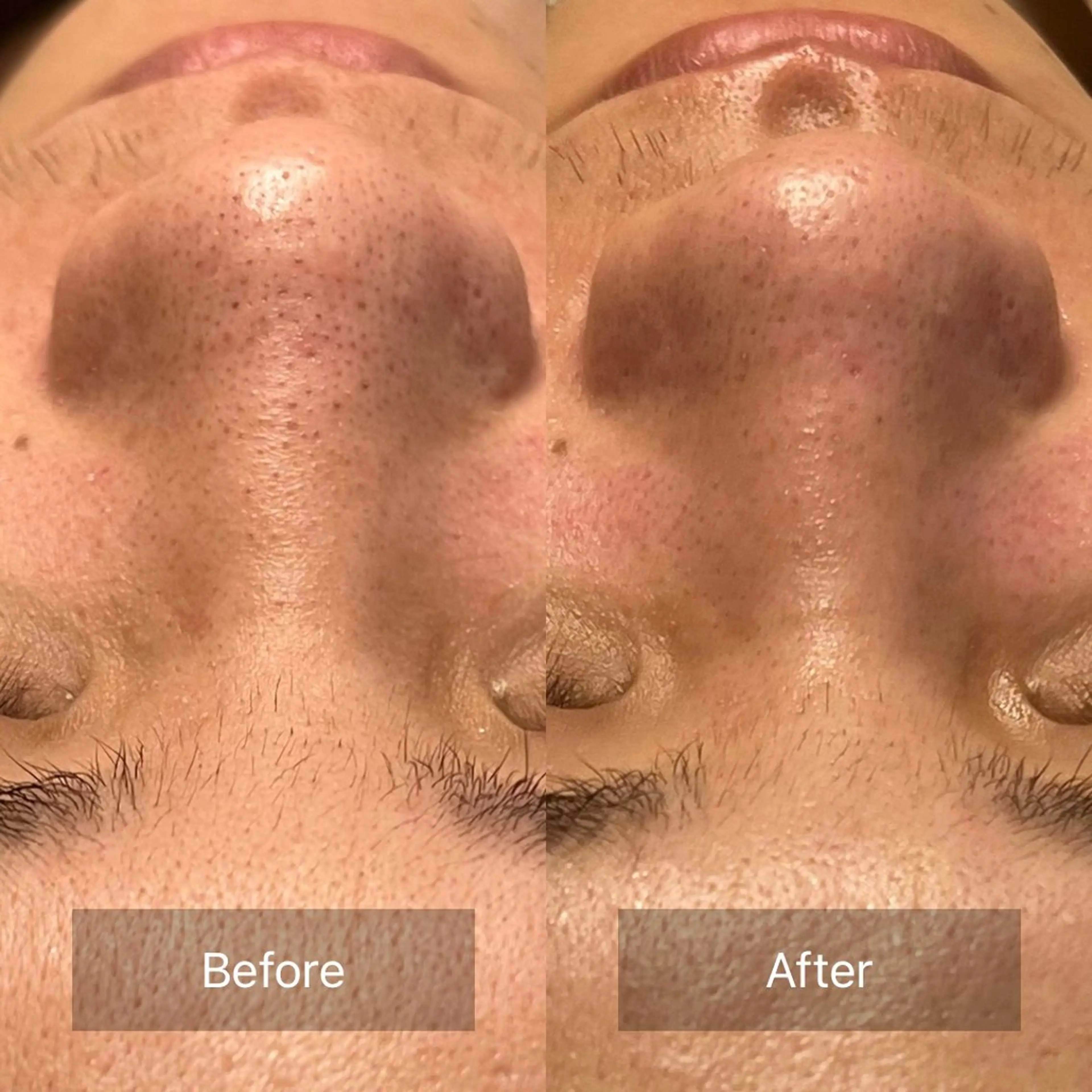 【頭痛、睡眠改善】 salon RUUのエステ・リラクイメージ