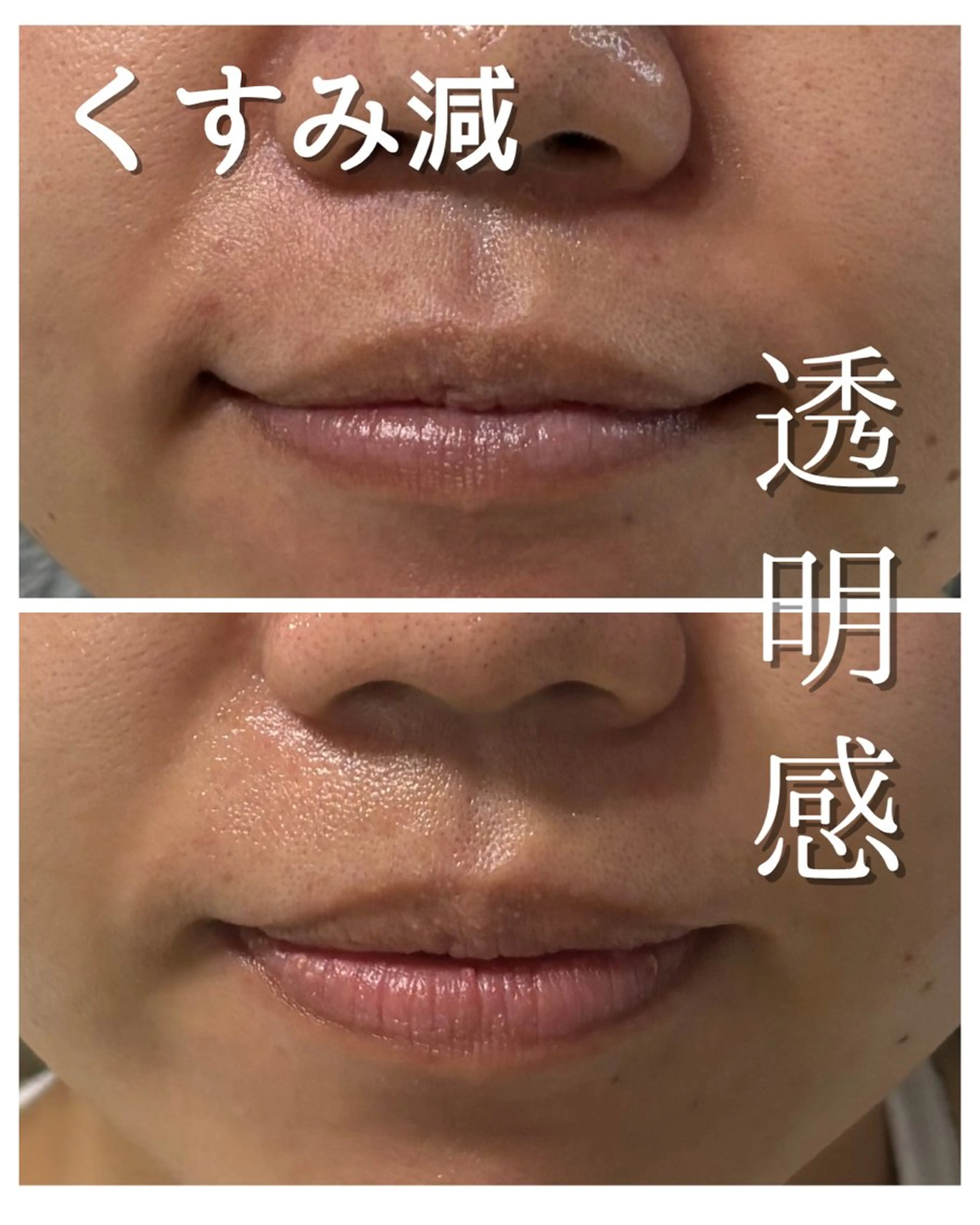 【つるん肌♪】ホームスキンケア付きエステ 8,700円→5,700円の写真