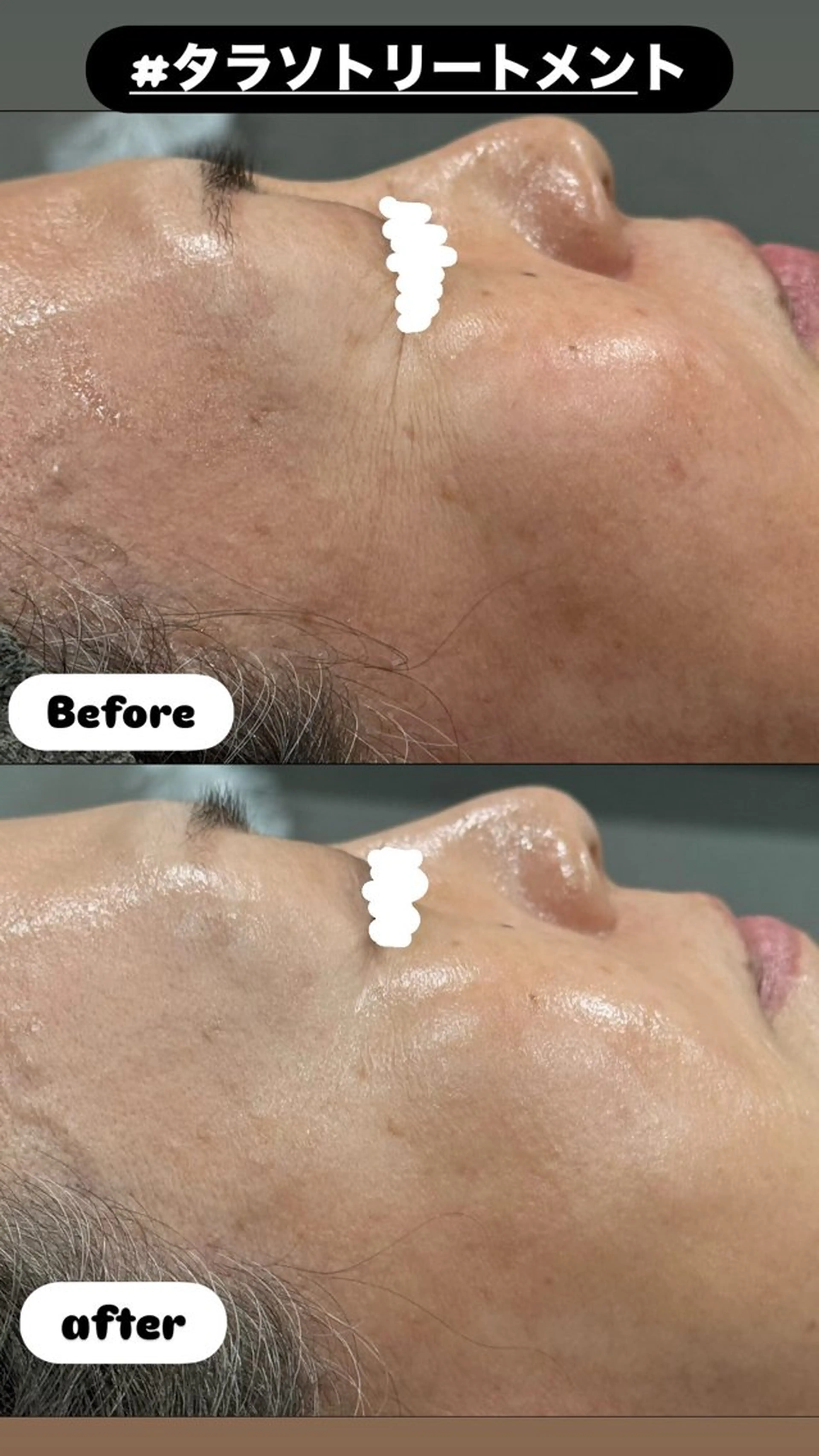 エステ LiZA エステティックサロンのエステ・リラクイメージ