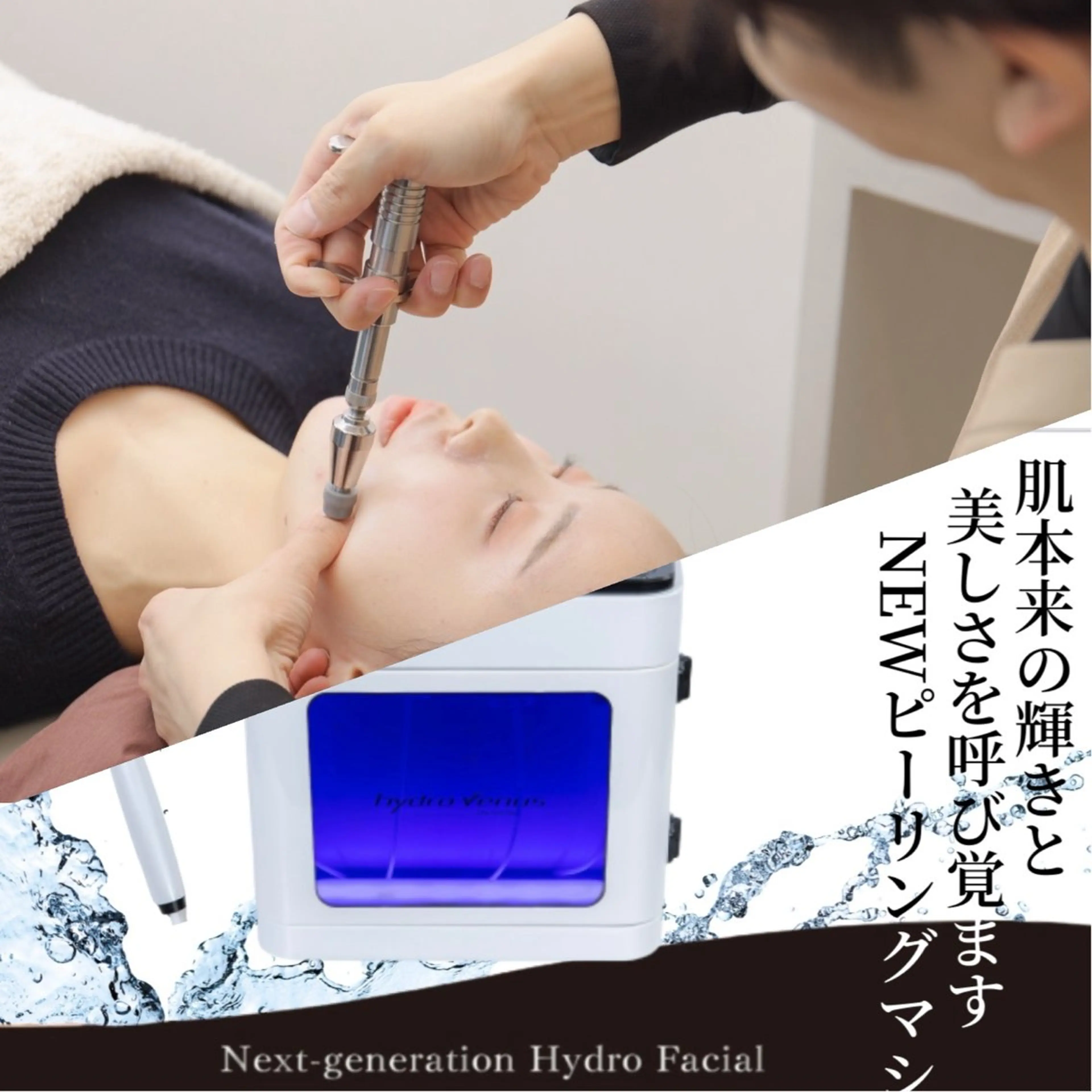 【小顔×黒ずみ】劇的小顔リフト💆‍♀️＋毛穴洗浄ハイドラフェイシャル　小顔矯正/たるみ/丸顔/エラ張り/角質角栓の写真