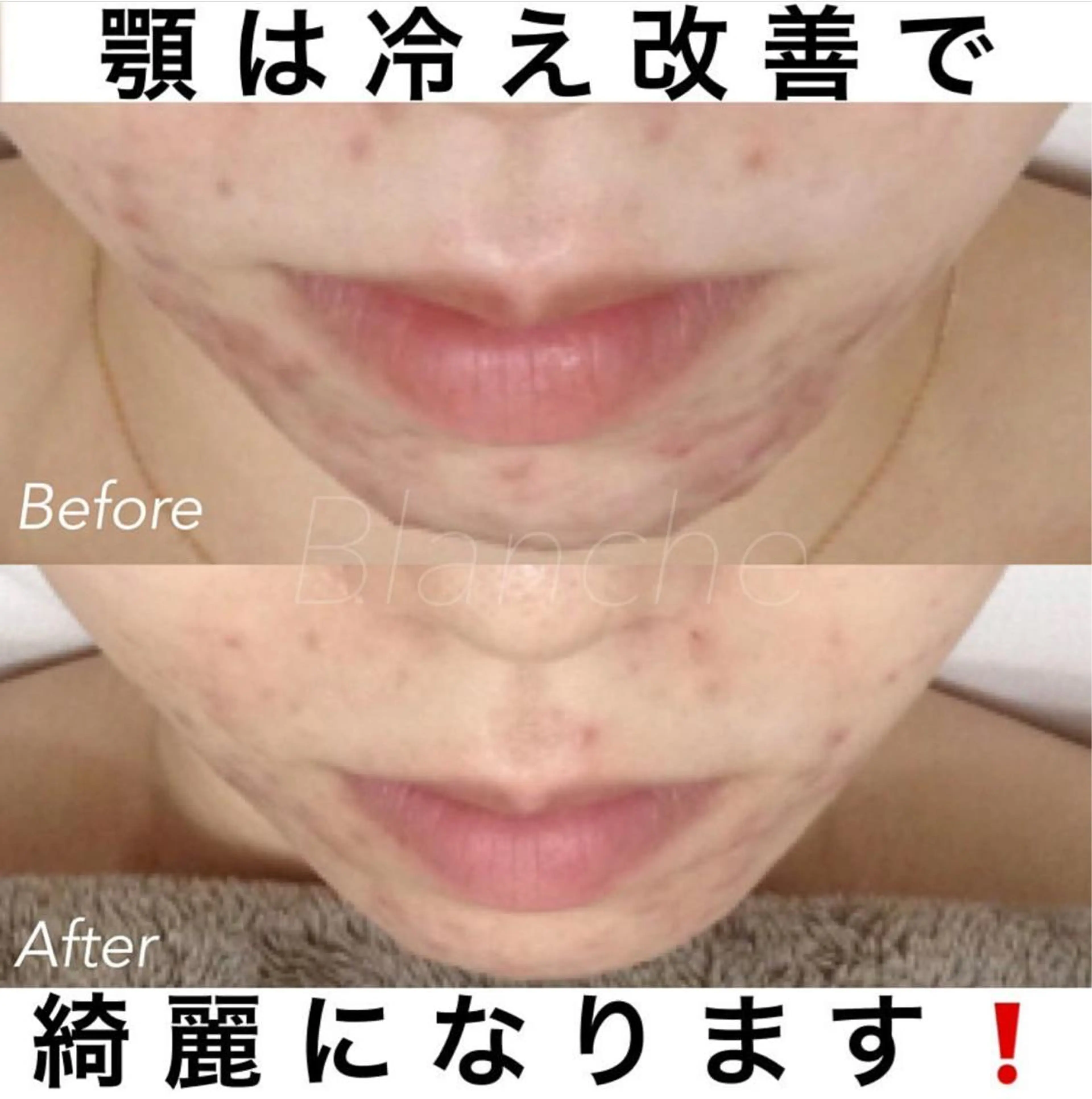 ショート カラー パーマ ヘアアレンジ ネイル マツエク・マツパ エステ リラク 都度払い肌質改善 &脱毛Blancheのエステ・リラクイメージ