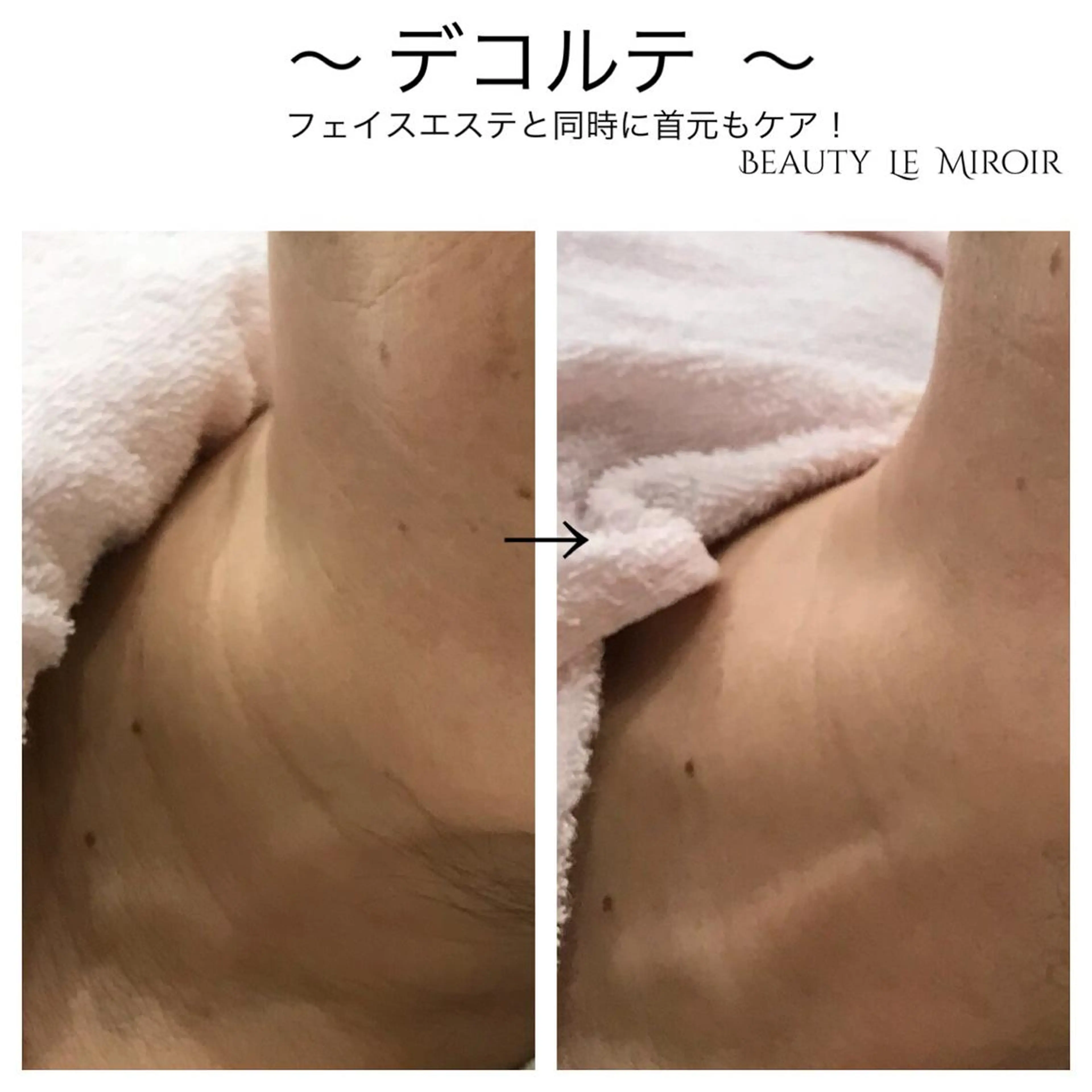 ビューティー ミロワールのエステ・リラクイメージ