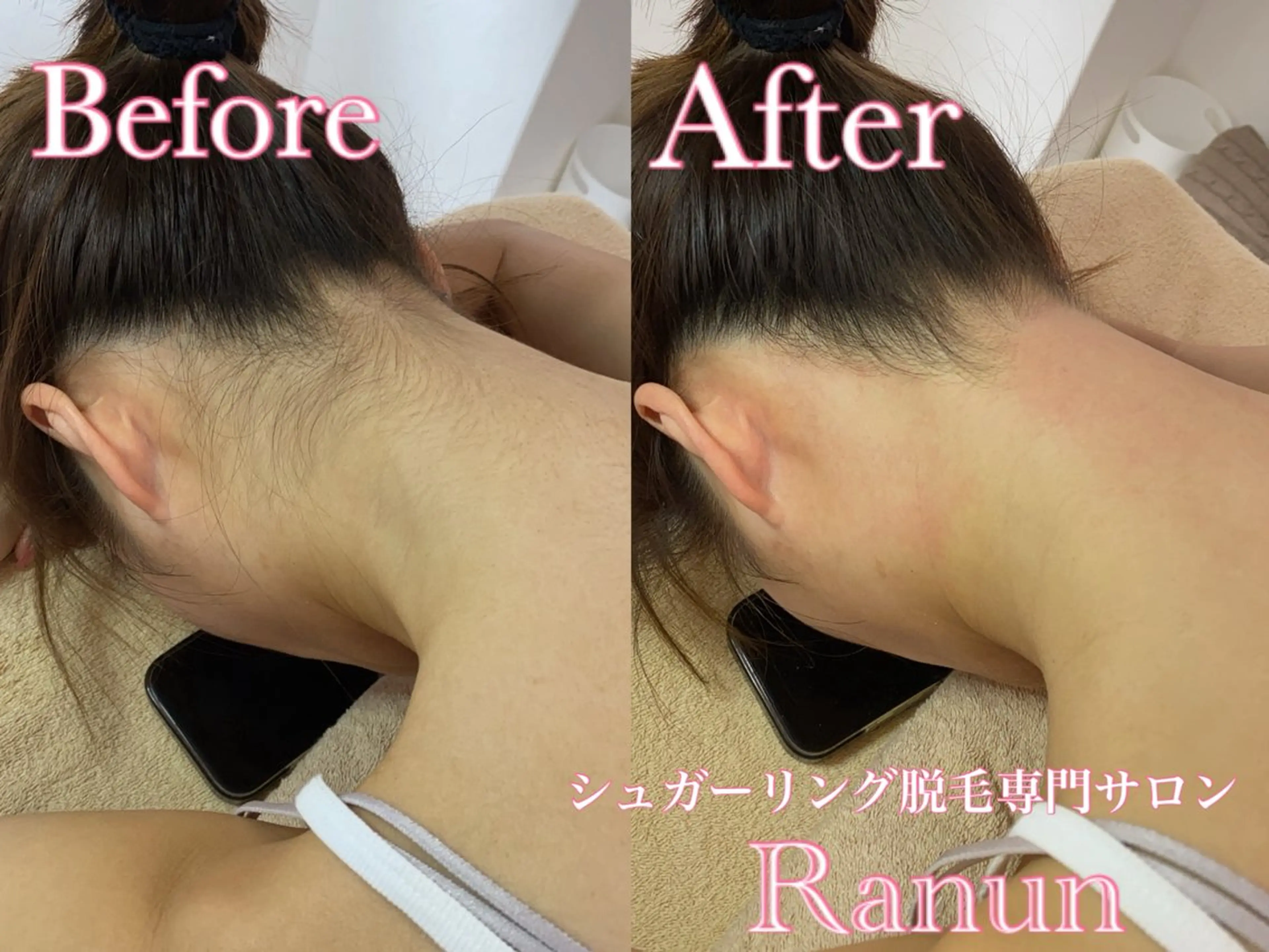 マツエク・マツパ 脱毛 シュガーリング脱毛 専門店Ranunのエステ・リラクイメージ