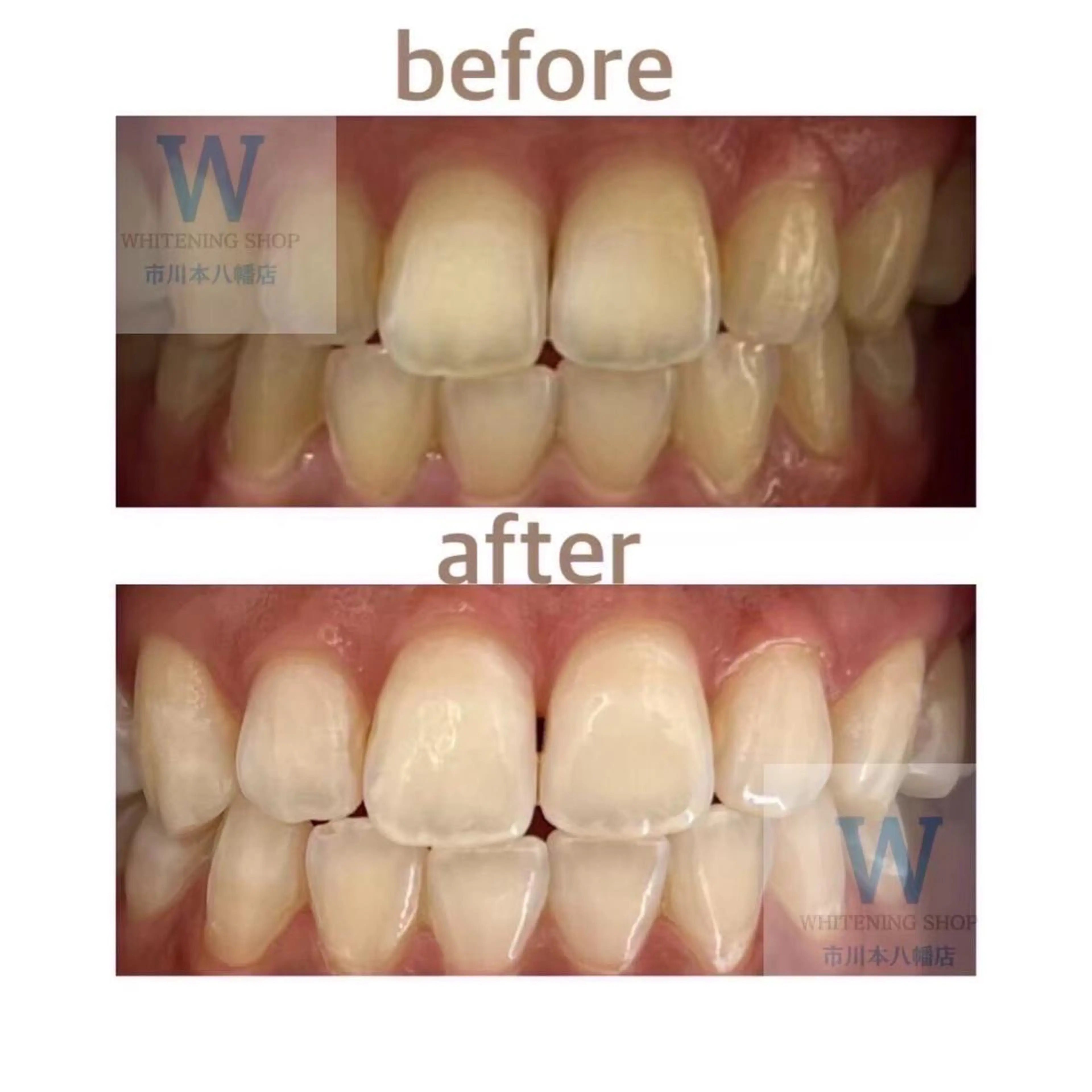 メンズ その他 ホワイトニング ショップ本八幡店のエステ・リラクイメージ