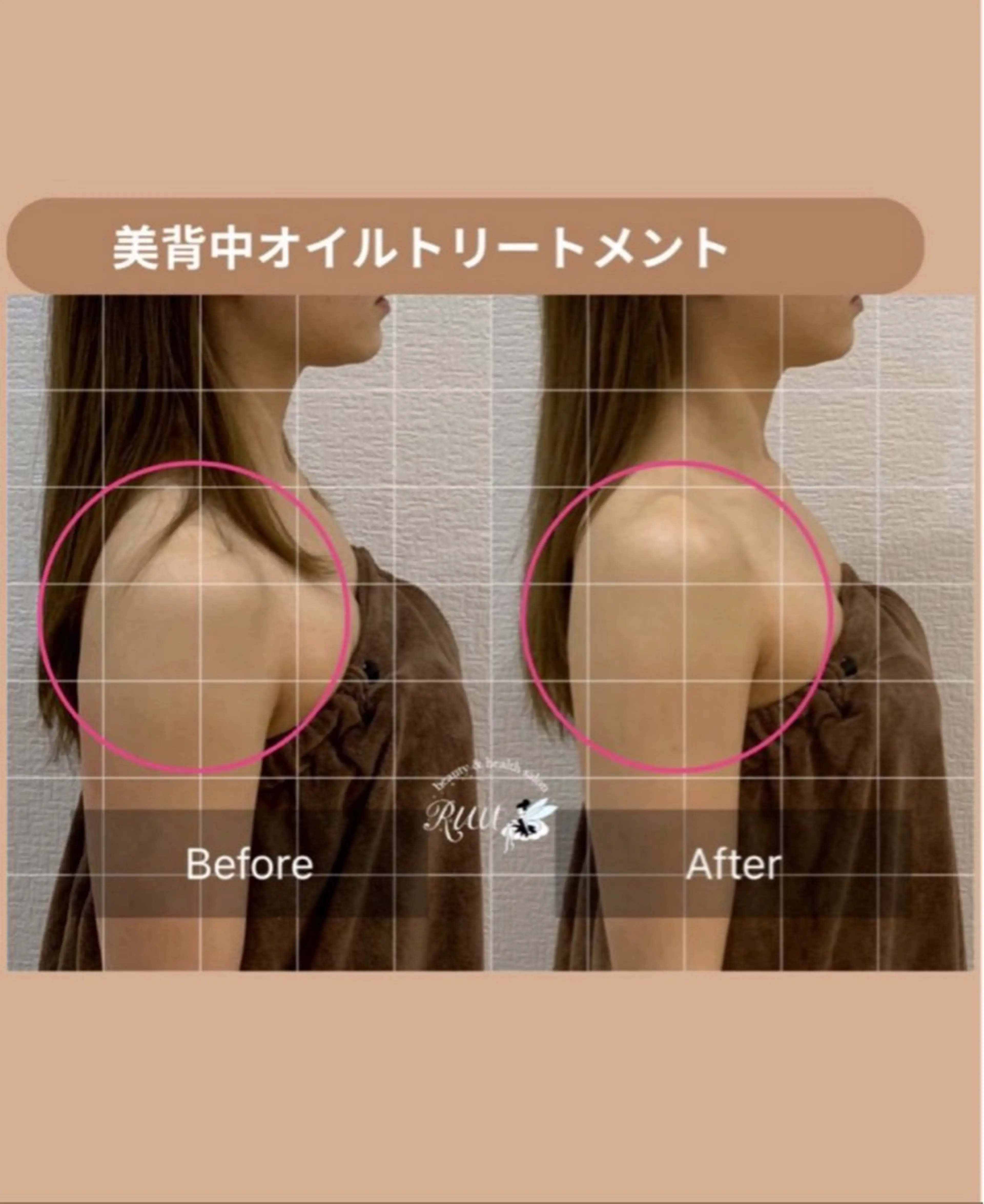 エステ リラク 【頭痛、睡眠改善】 salon RUUのエステ・リラクイメージ