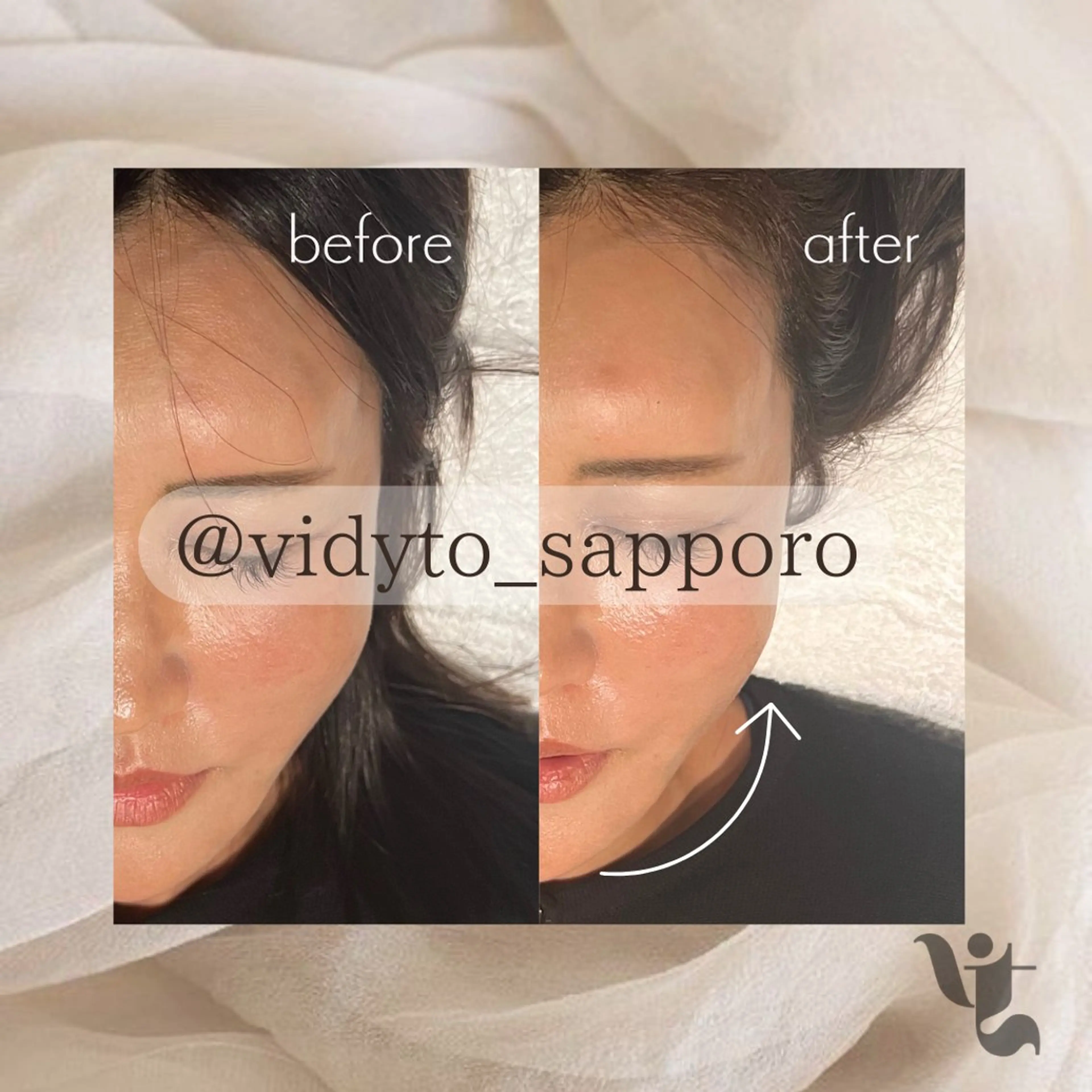 【vidyto】ヴィディトゥ所属・肌管理サロン vidyto　MOEのエステ・リラクイメージ