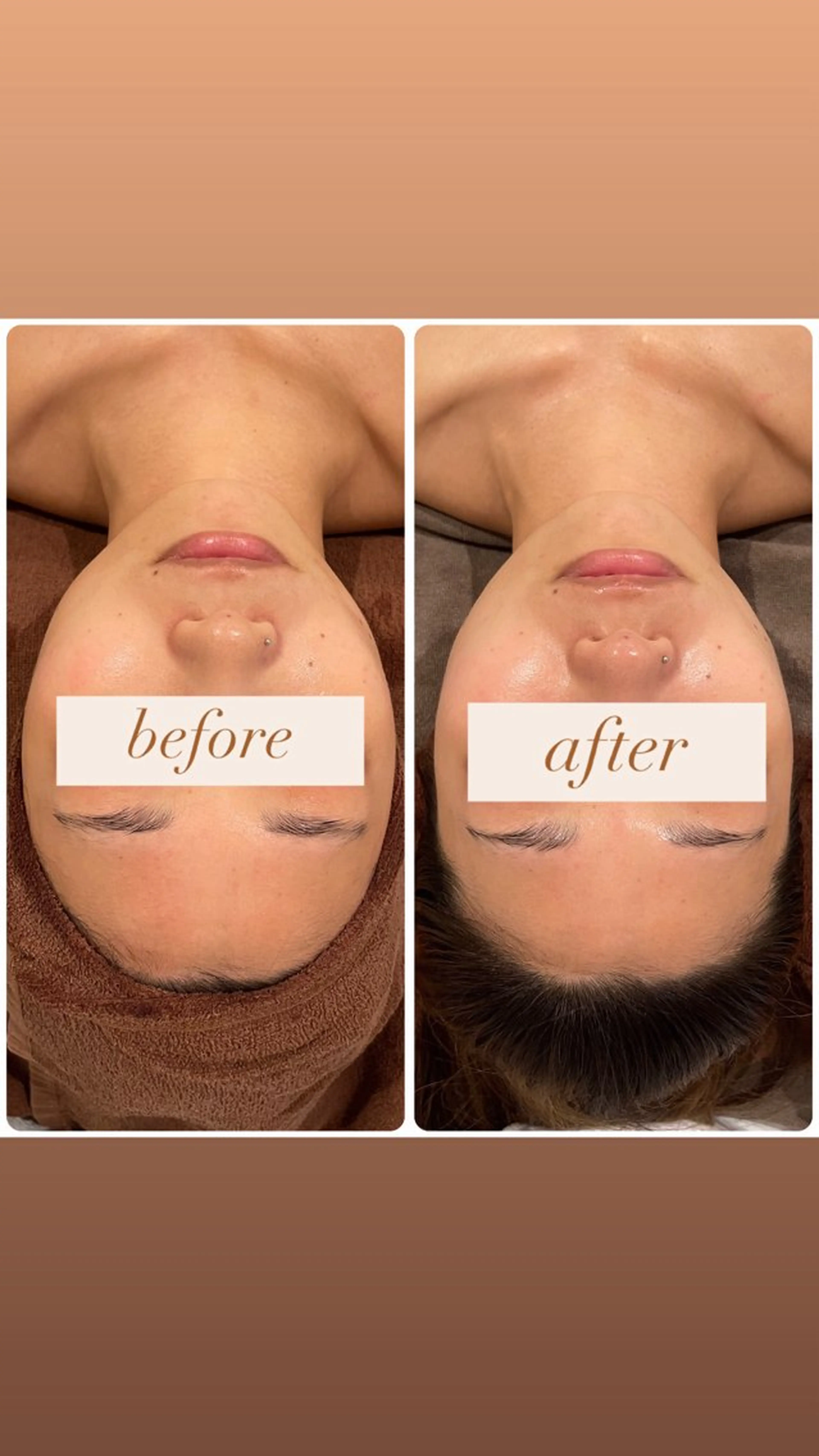 【小顔×毛穴🌿】小顔＋毛穴洗浄🧖🏻‍♀️ ◎毛穴詰まりや皮脂でざらつきを感じる方にオススメ！の写真