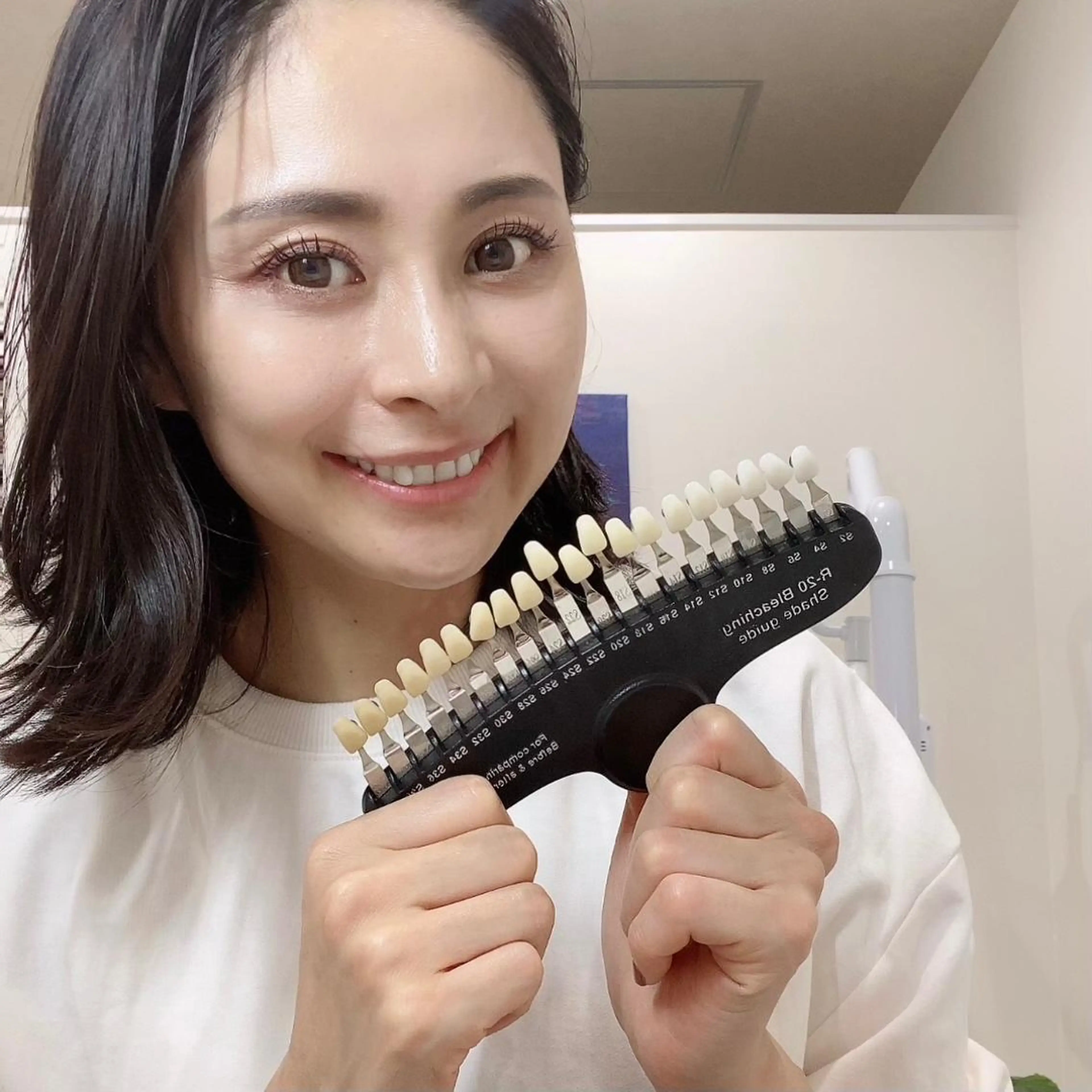 White Berry SELF BEAUTY SALON所属・セルフホワイトニング 🦷口元垢抜け✨のその他イメージ