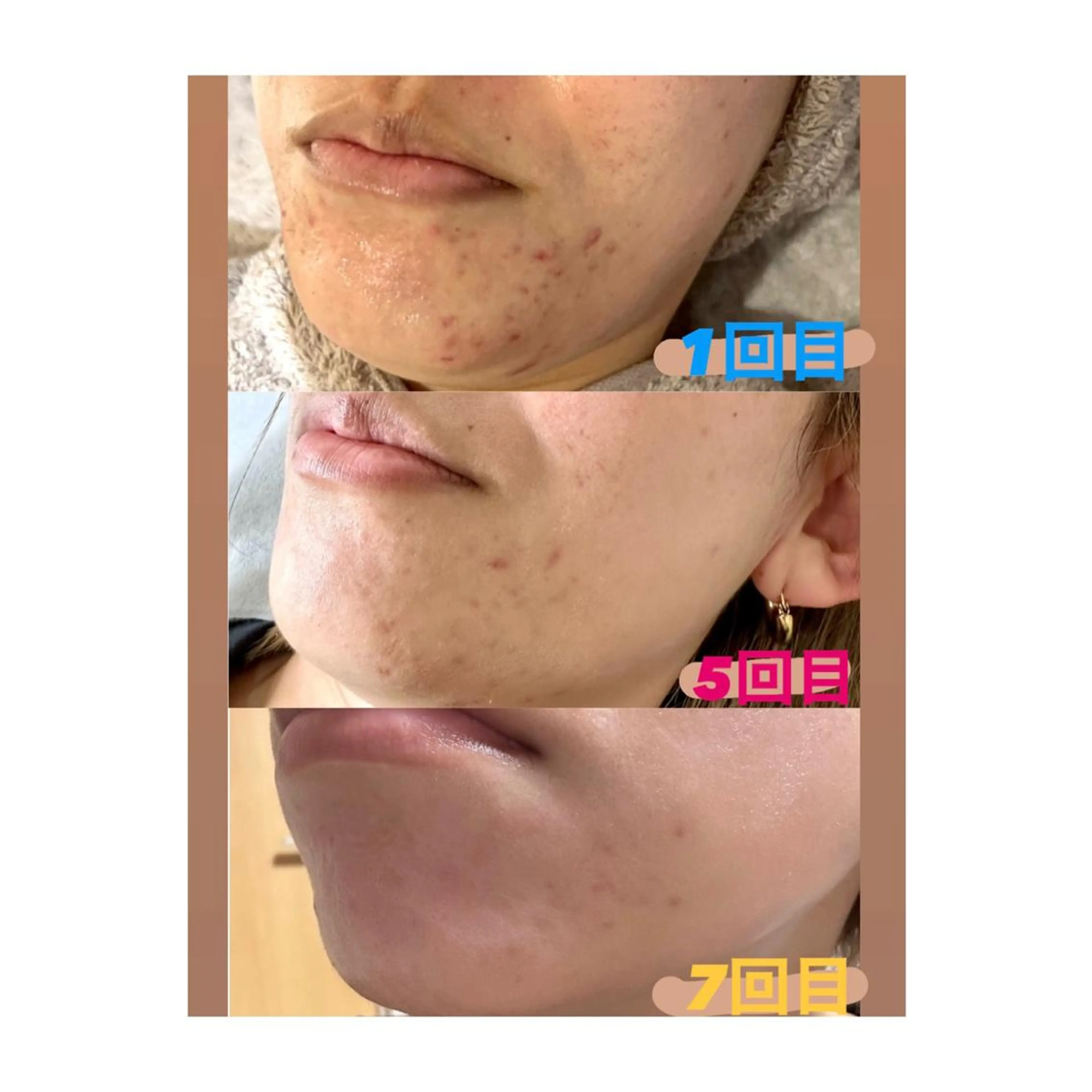 脱毛&美容サロンBLUESEA所属・脱毛&美容サロン BLUESEAのエステ・リラクイメージ