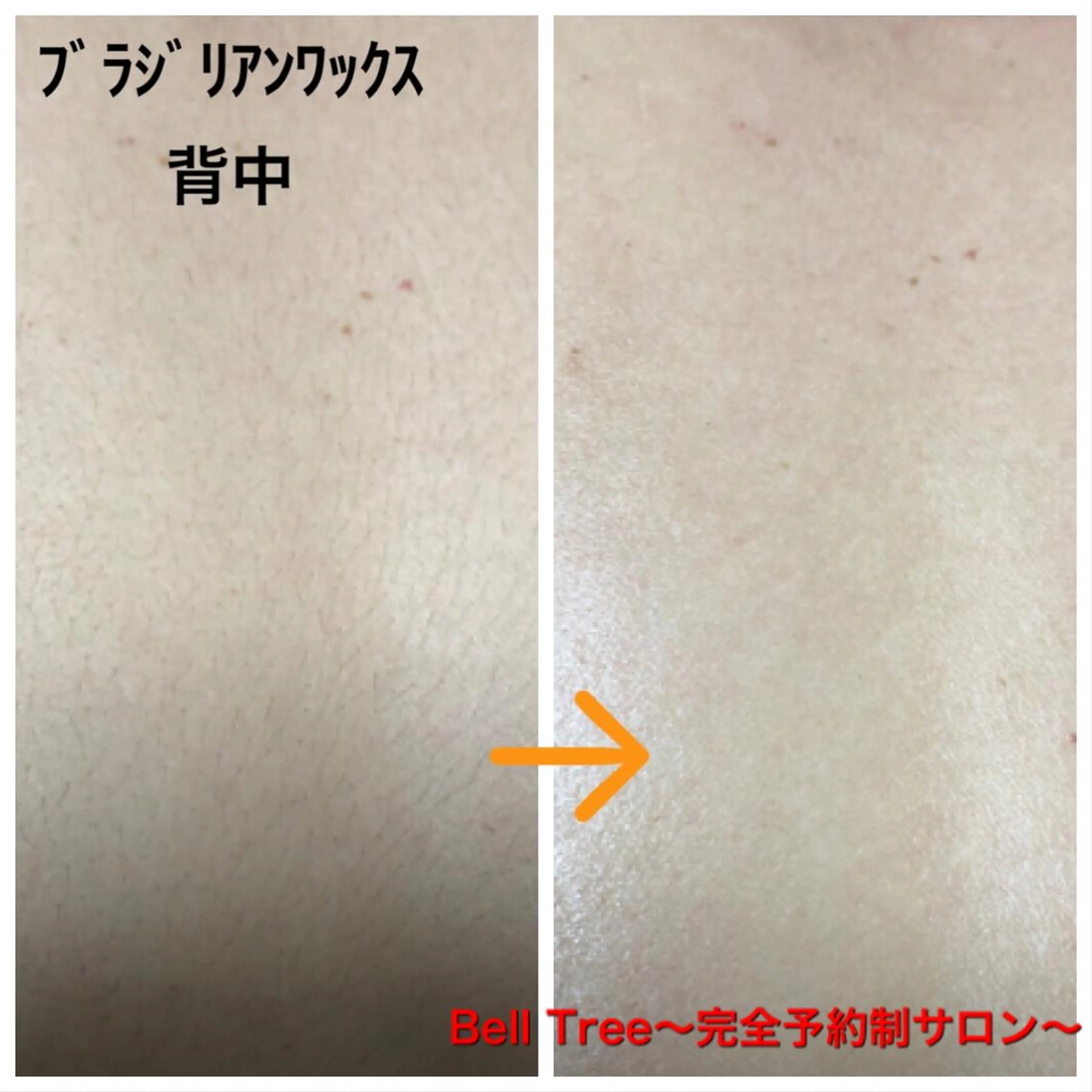 Bell Tree すずきのエステ・リラクイメージ