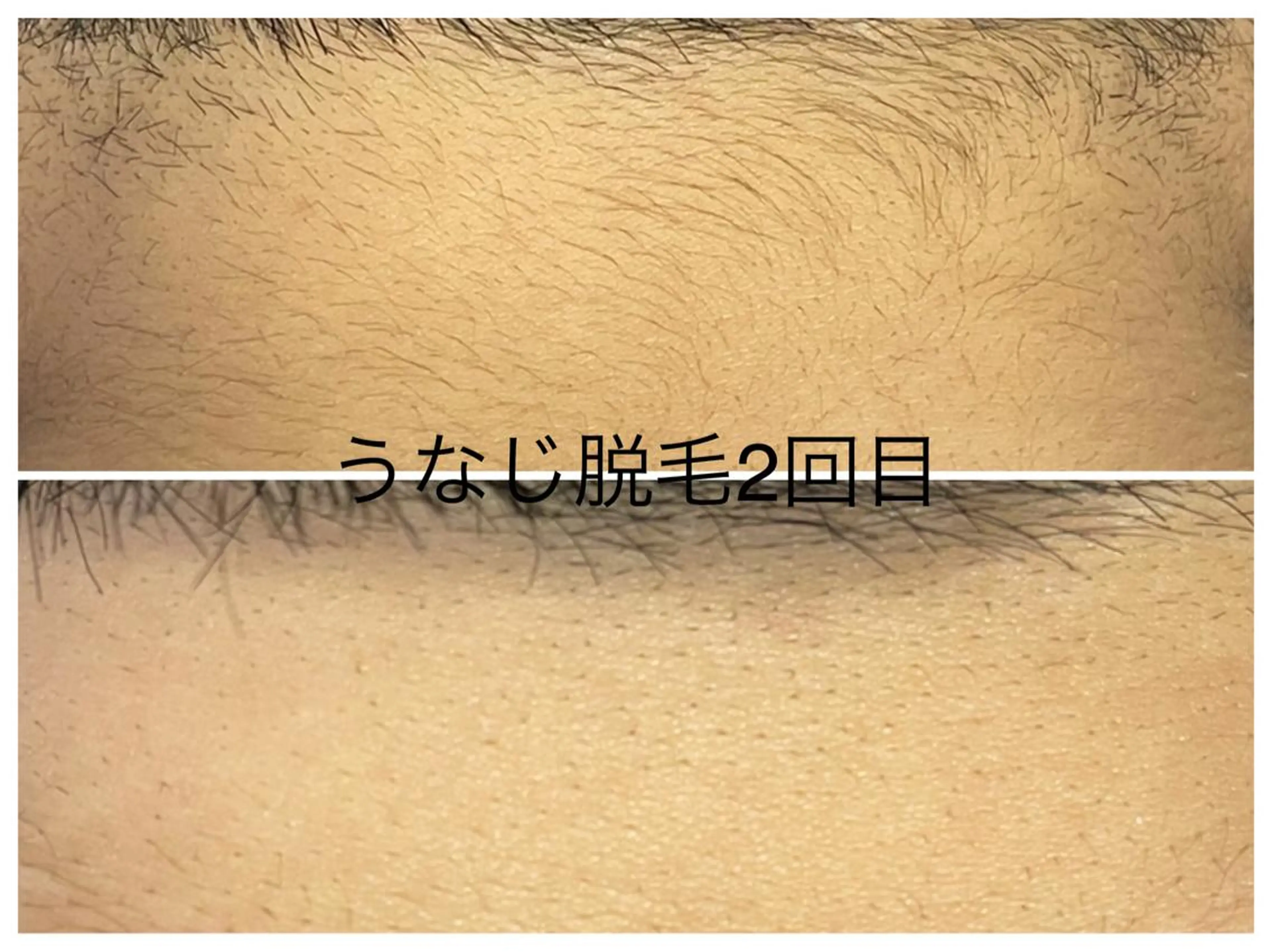 メンズ 医療提携メンズ脱毛 CDFAkasakaのエステ・リラクイメージ