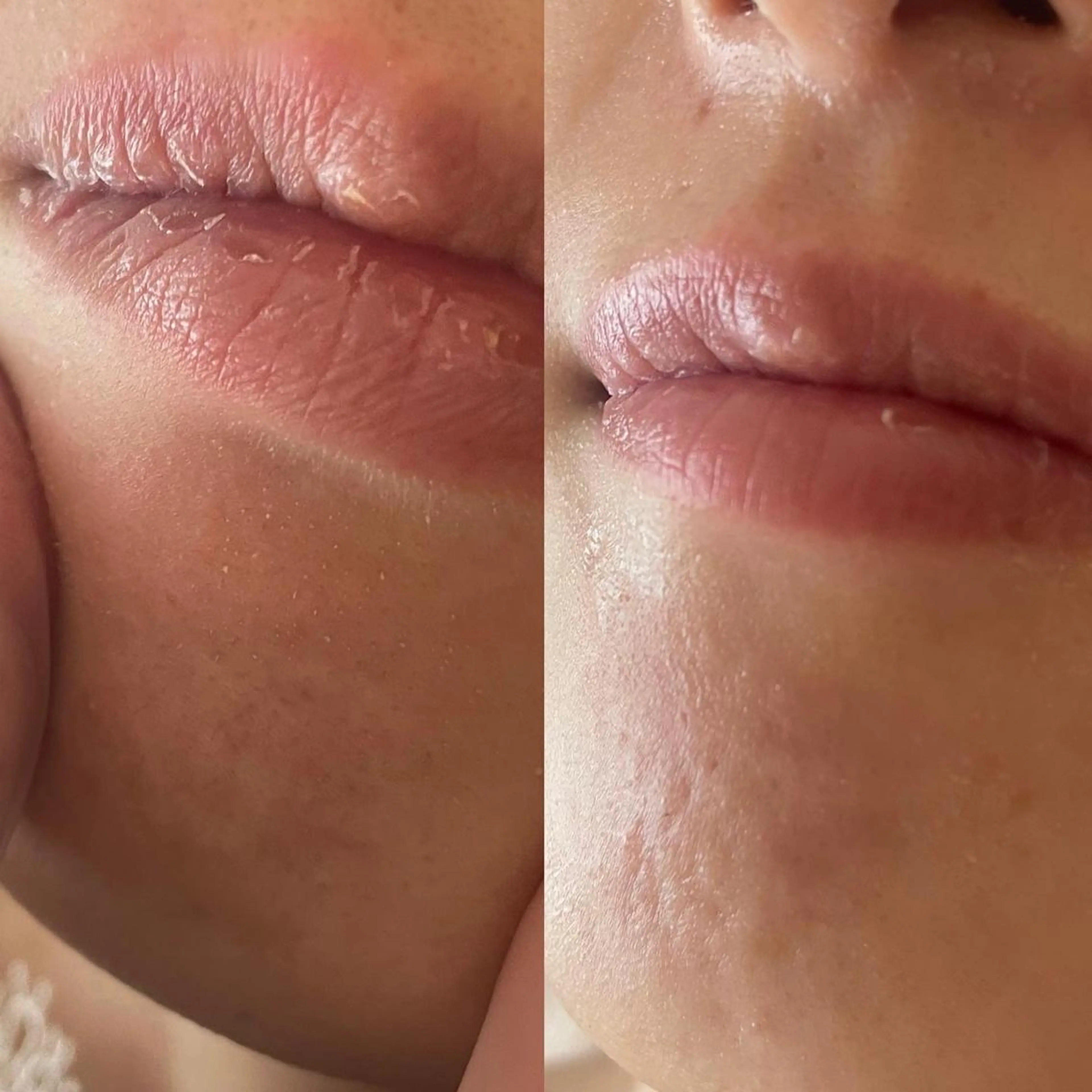 amu nail. RINAのネイルデザイン