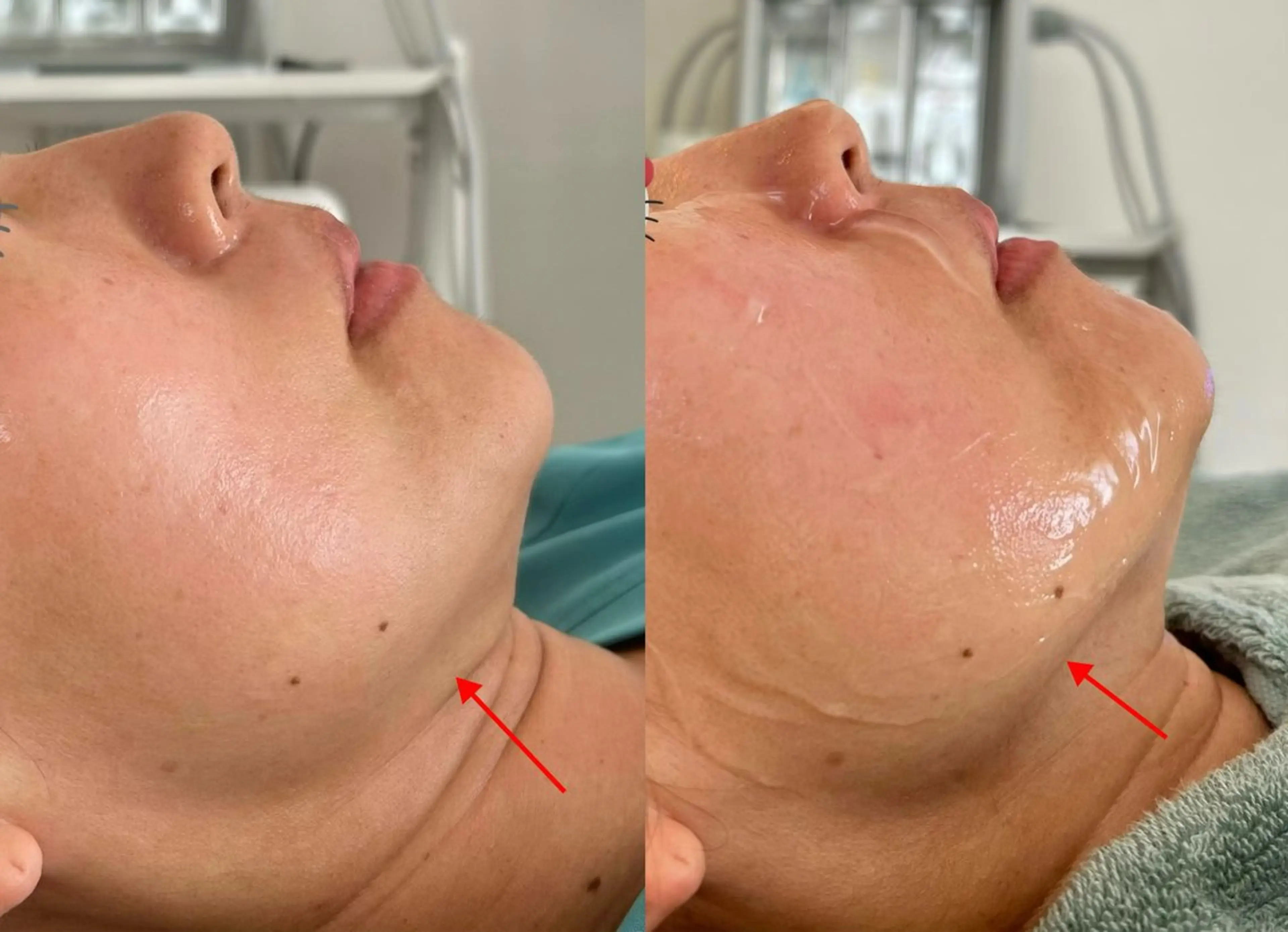 ホワイティアビシェル ウラワ　白澤奇のその他イメージ