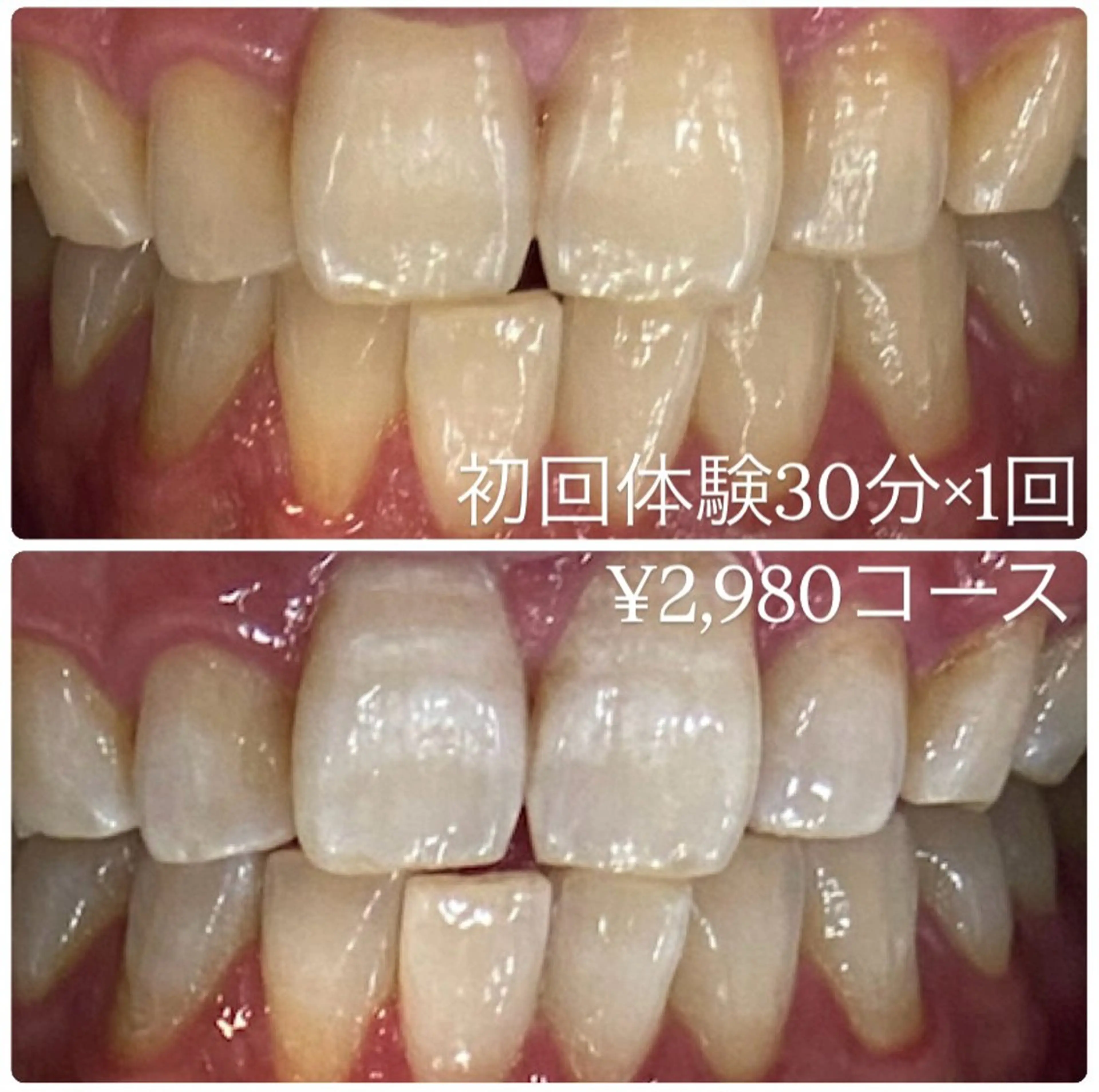 PLATINUM Beauty 横浜店所属・ホワイトニングルーム 横浜店のその他イメージ