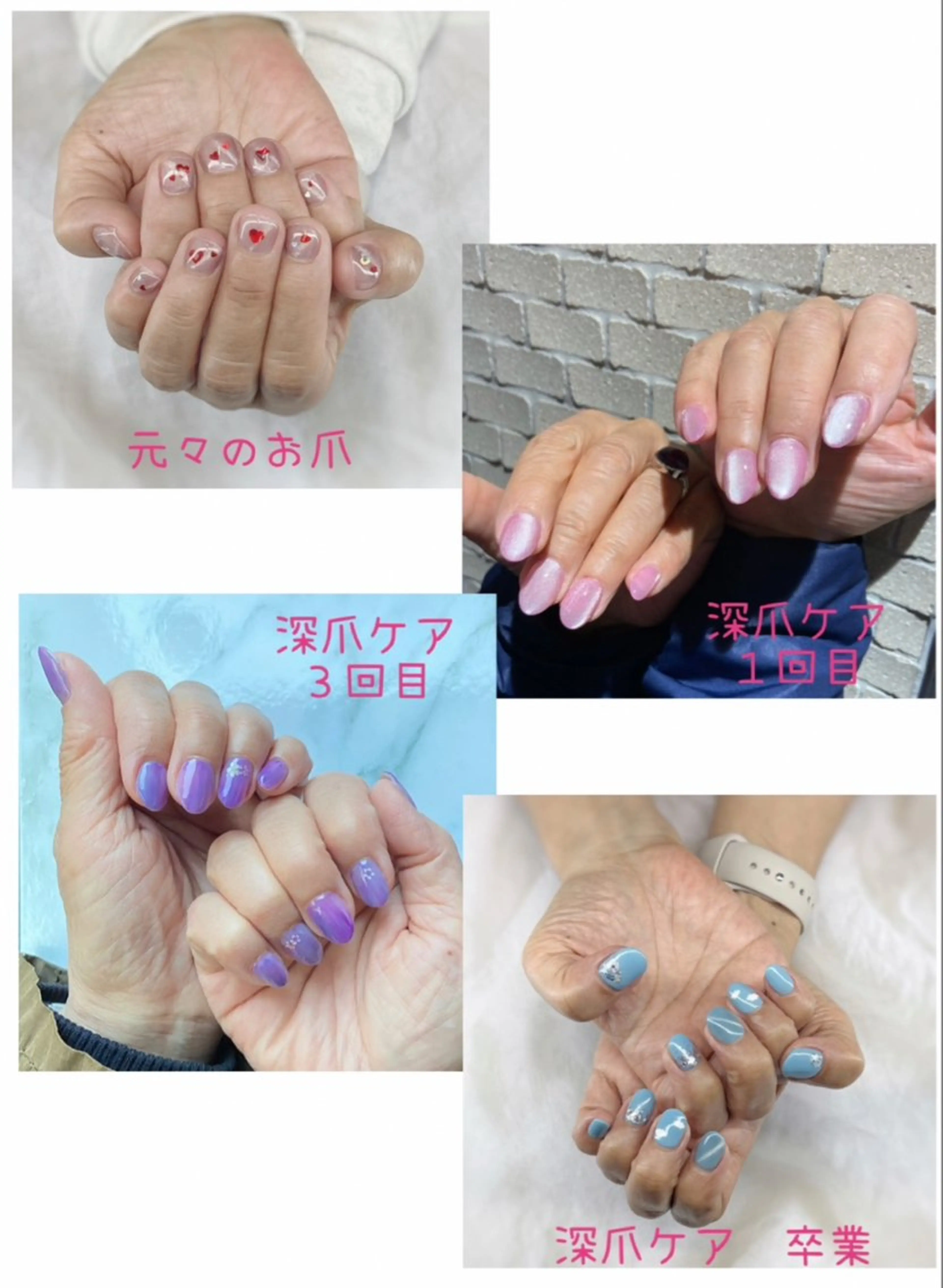 深爪ケア（ワンカラー）　モニター募集の写真