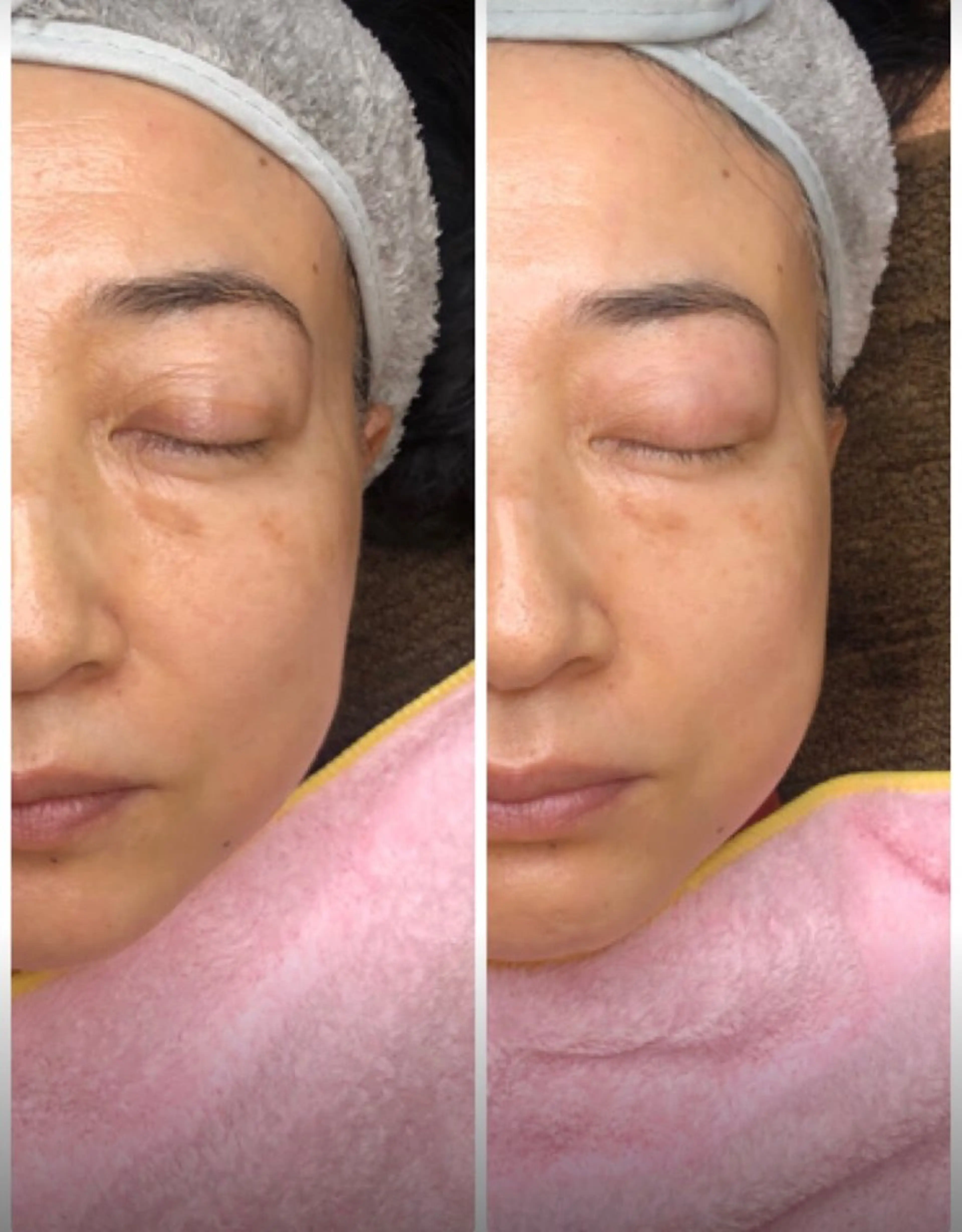 かすがい鍼灸院Re.heart所属・かすがい鍼灸院 Re.heartのエステ・リラクイメージ