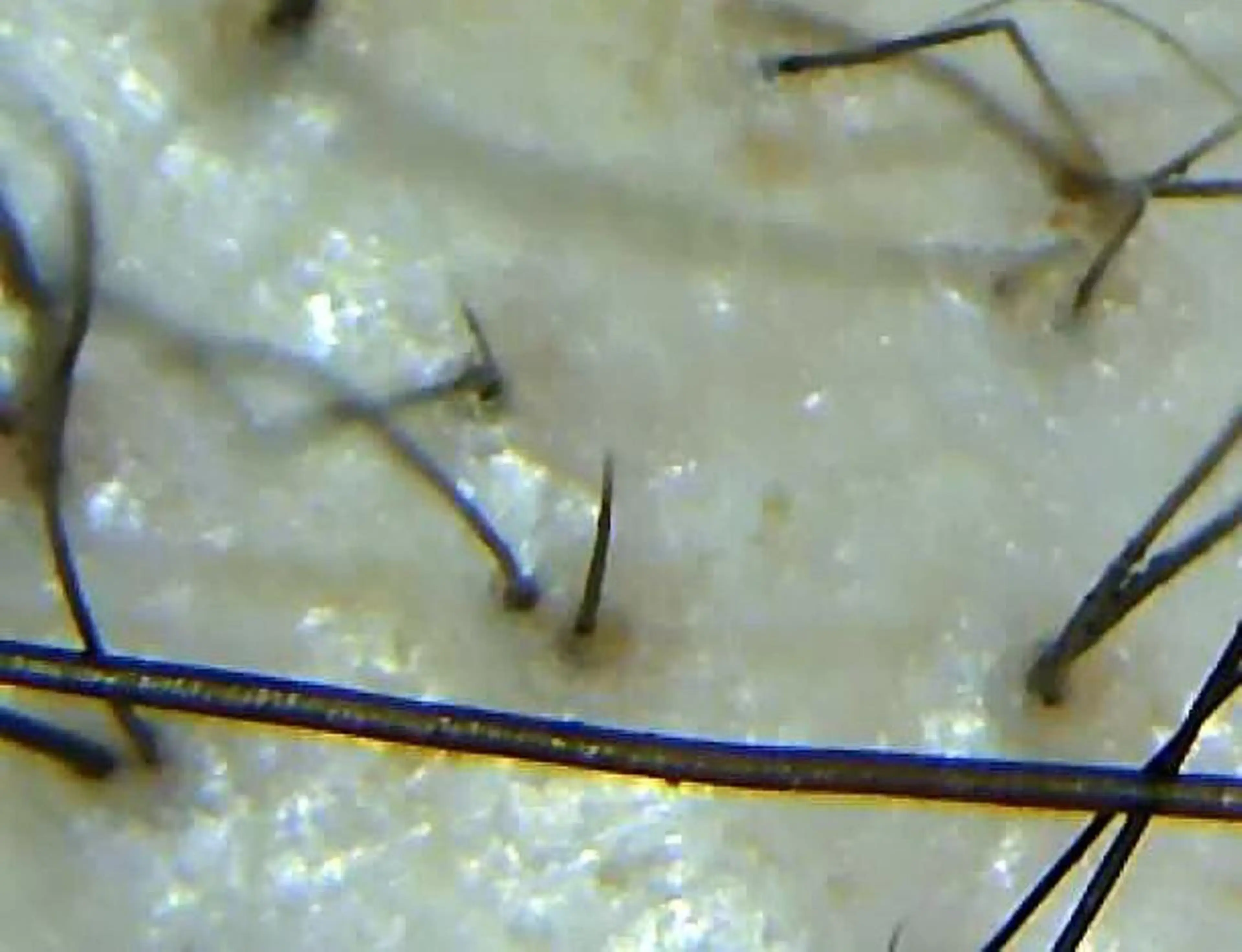 その他 セントラル鍼灸院 Re:laxyのエステ・リラクイメージ