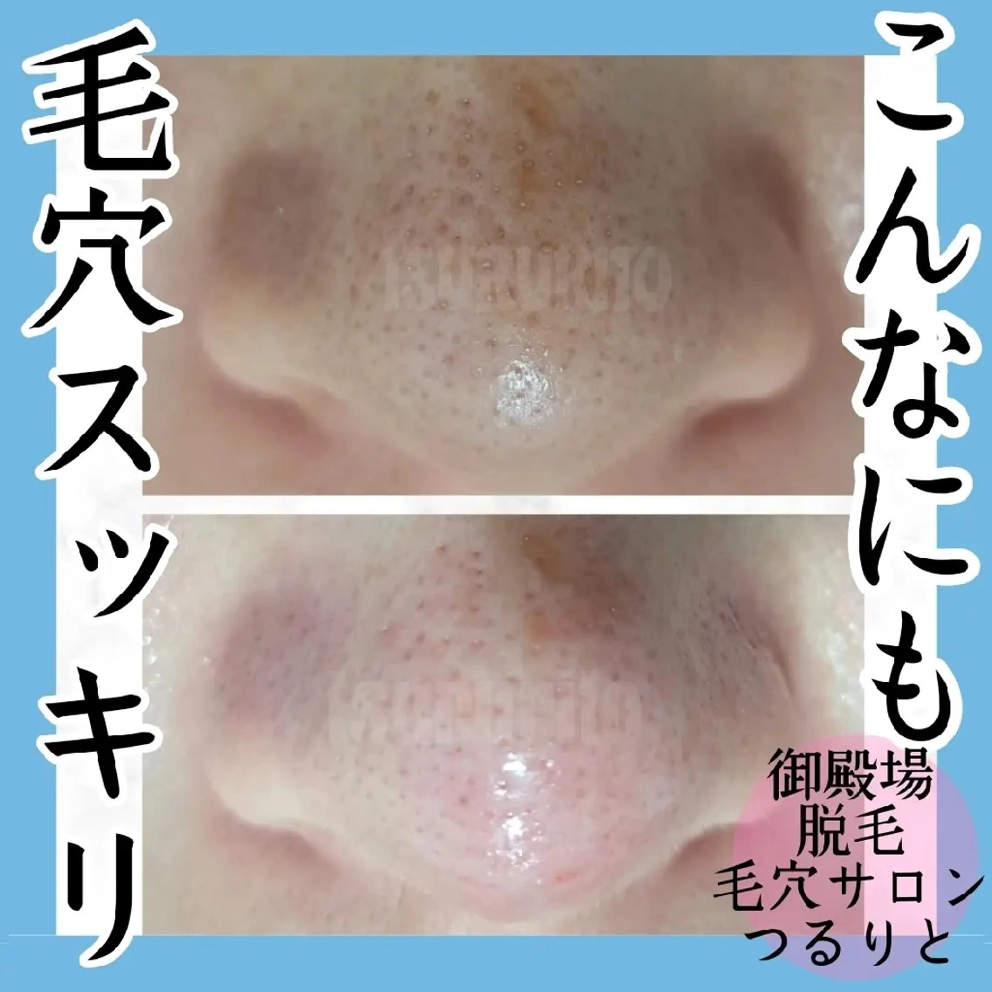 美肌脱毛サロン つるりと御殿場店所属・美肌脱毛サロン つるりとのその他イメージ