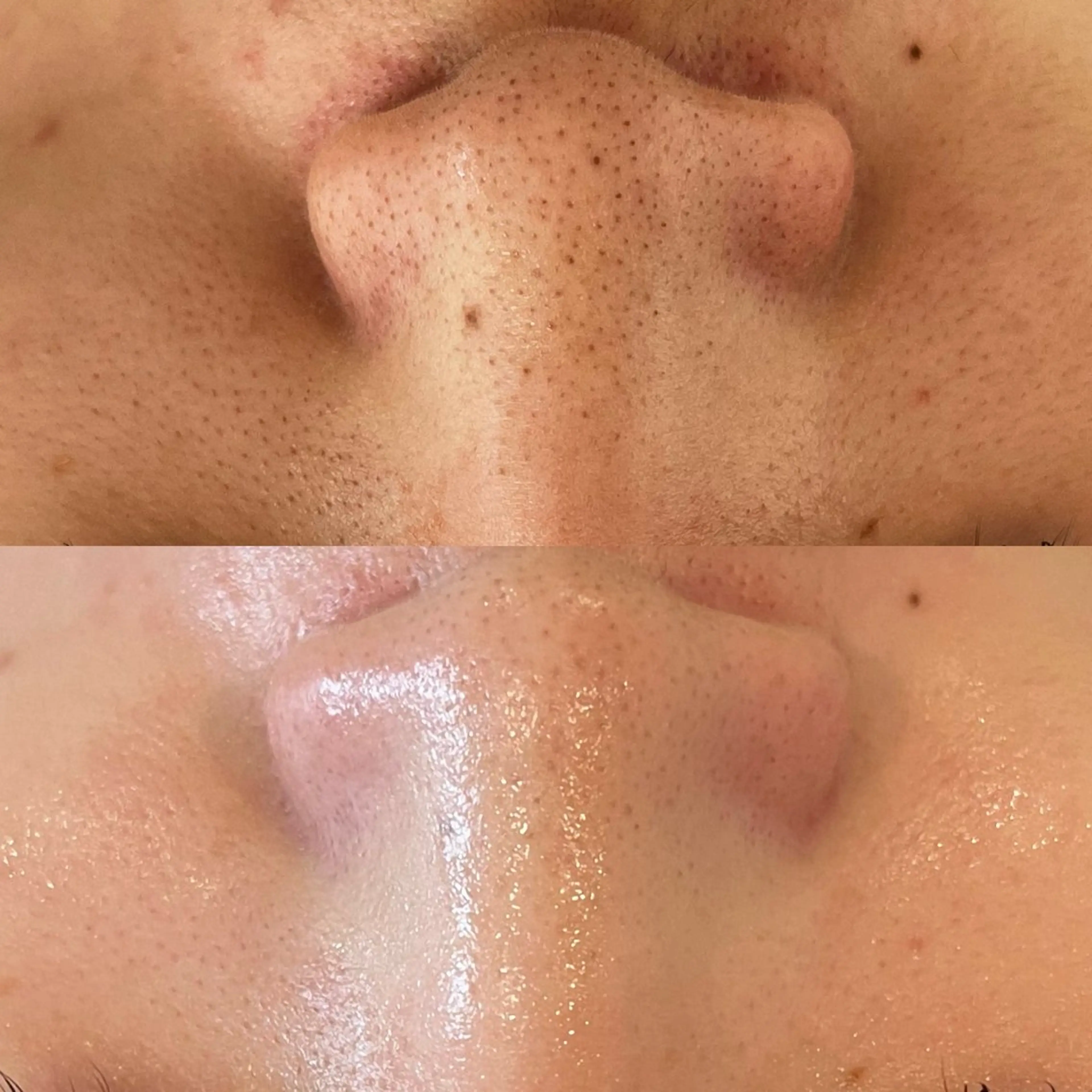 脱毛 gypsofia ジプソフィアのネイルデザイン