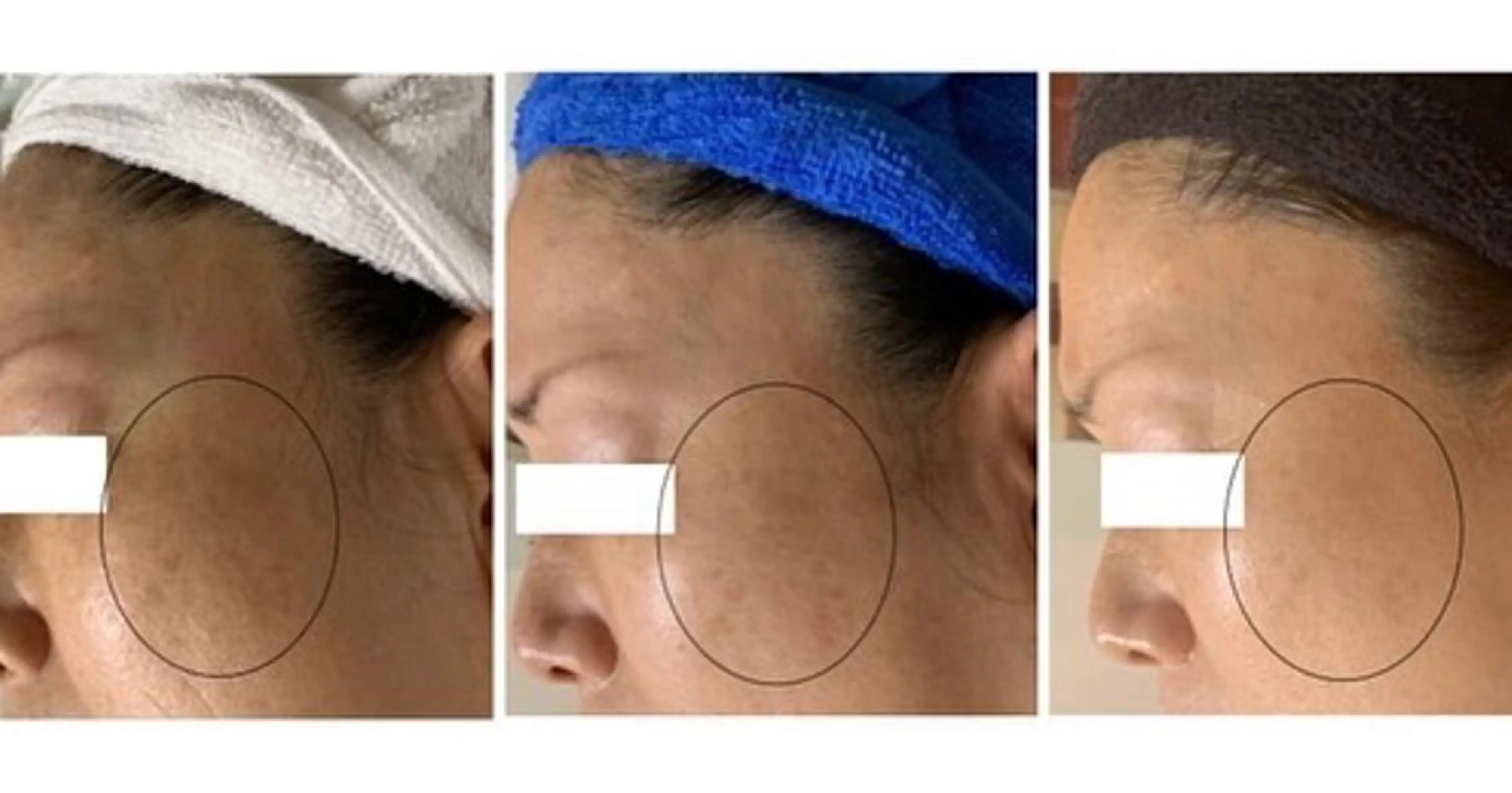 エステ ヴィーナス ビューティーのエステ・リラクイメージ