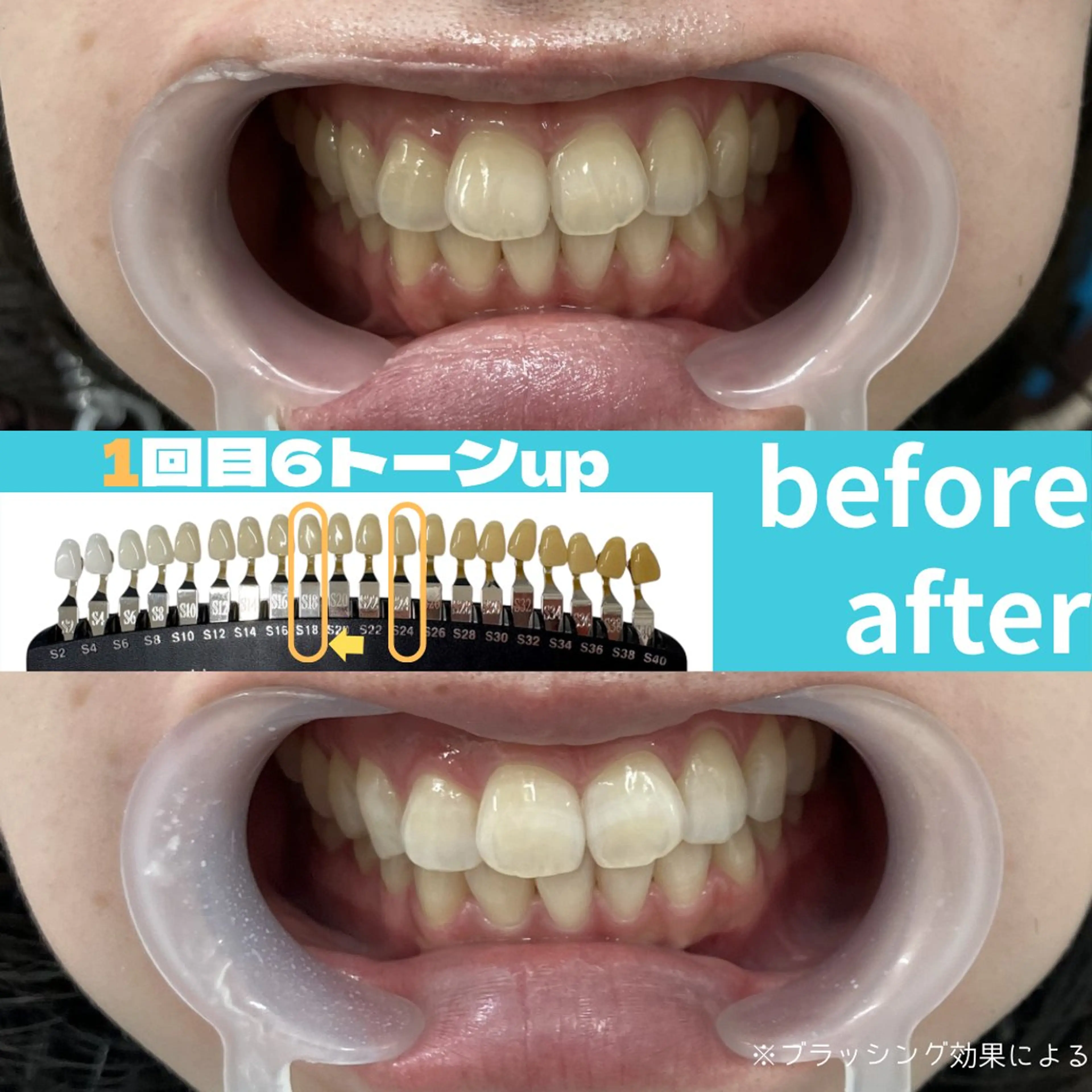 エステ s rikoのエステ・リラクイメージ