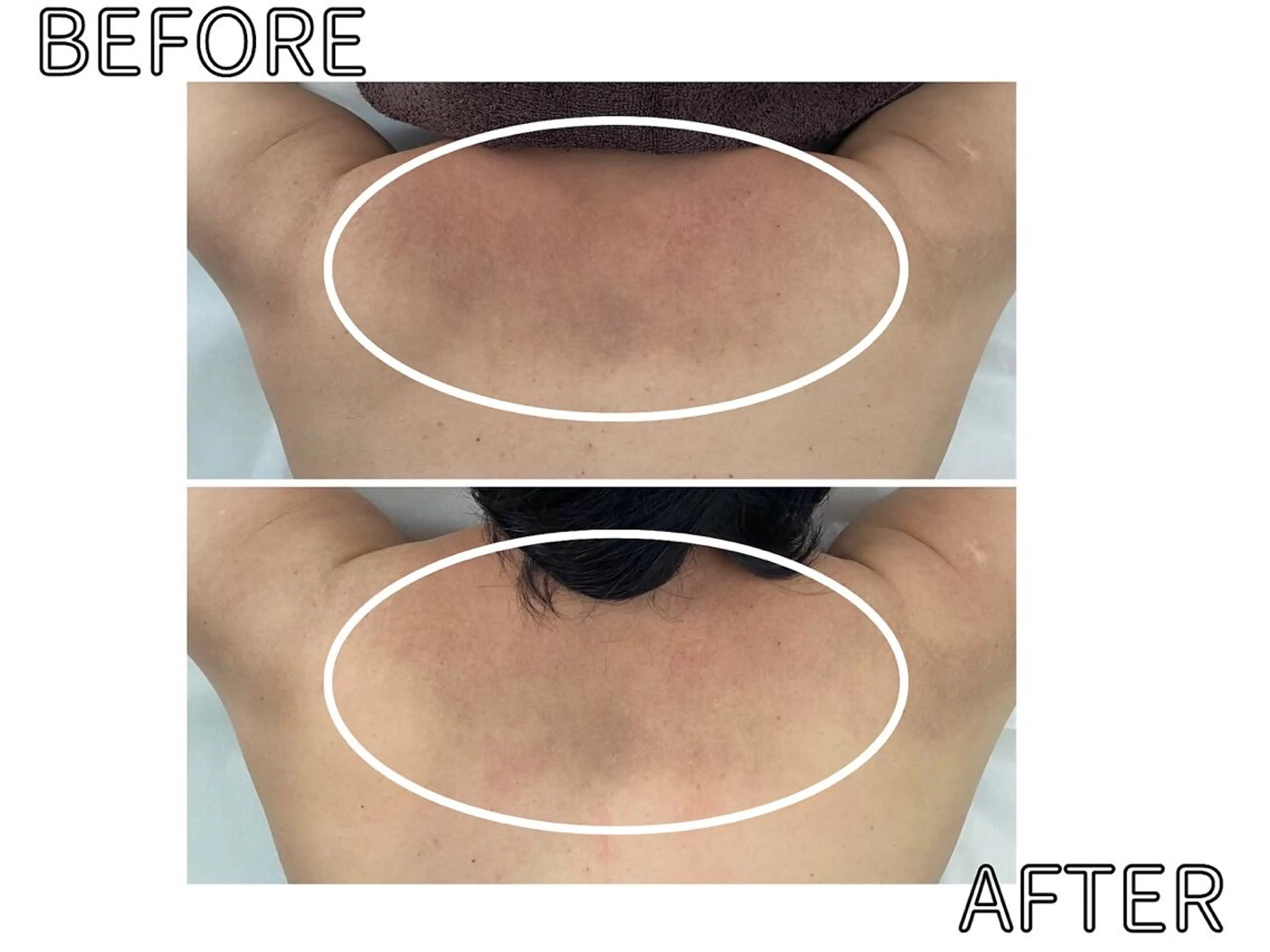 ハーブピーリング LIME池袋東口のエステ・リラクイメージ