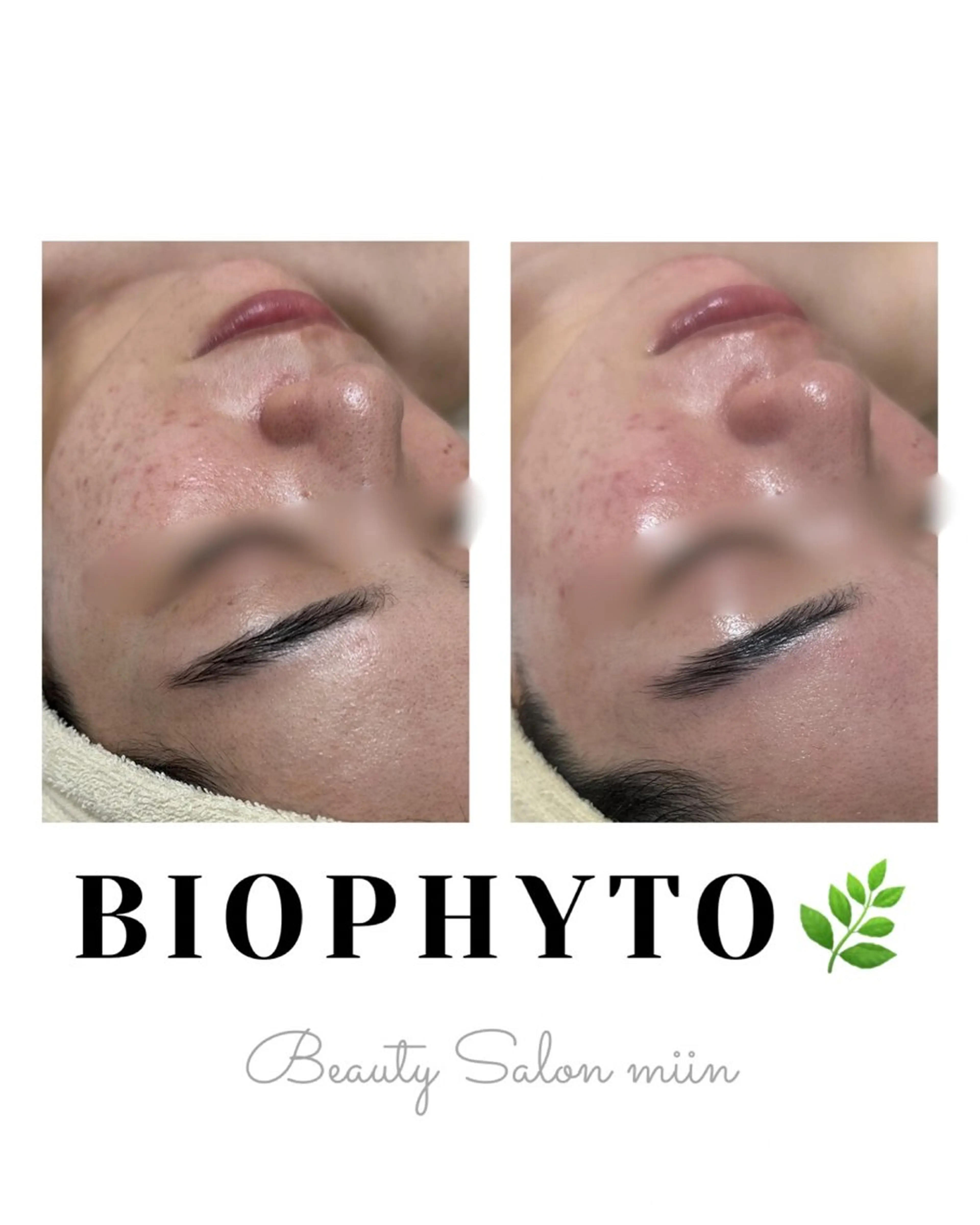 リラク 韓国肌管理 白玉肌管理®︎のエステ・リラクイメージ