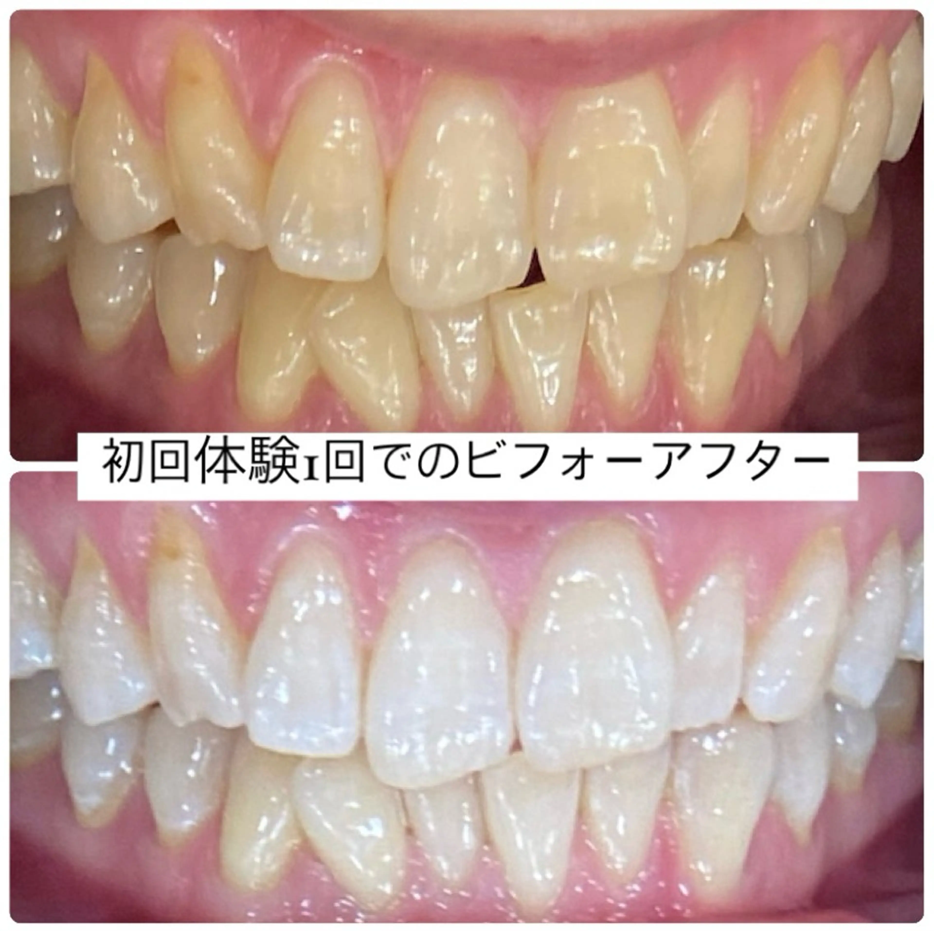 PLATINUM Beauty 横浜店所属・ホワイトニングルーム 横浜店のその他イメージ