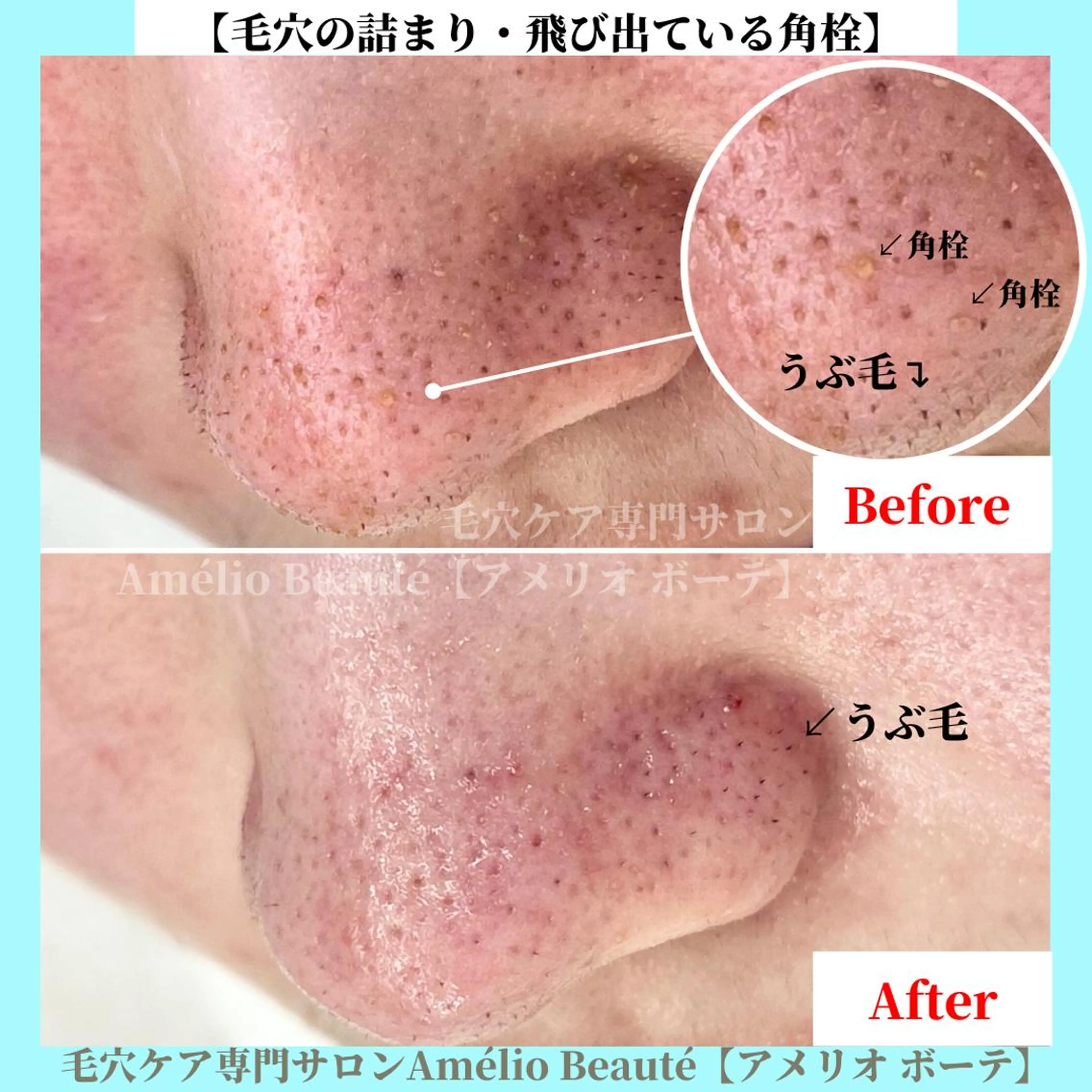 毛穴ケア専門サロン Amélio Beauté所属・毛穴ケア専門サロン アメリオボーテのその他イメージ