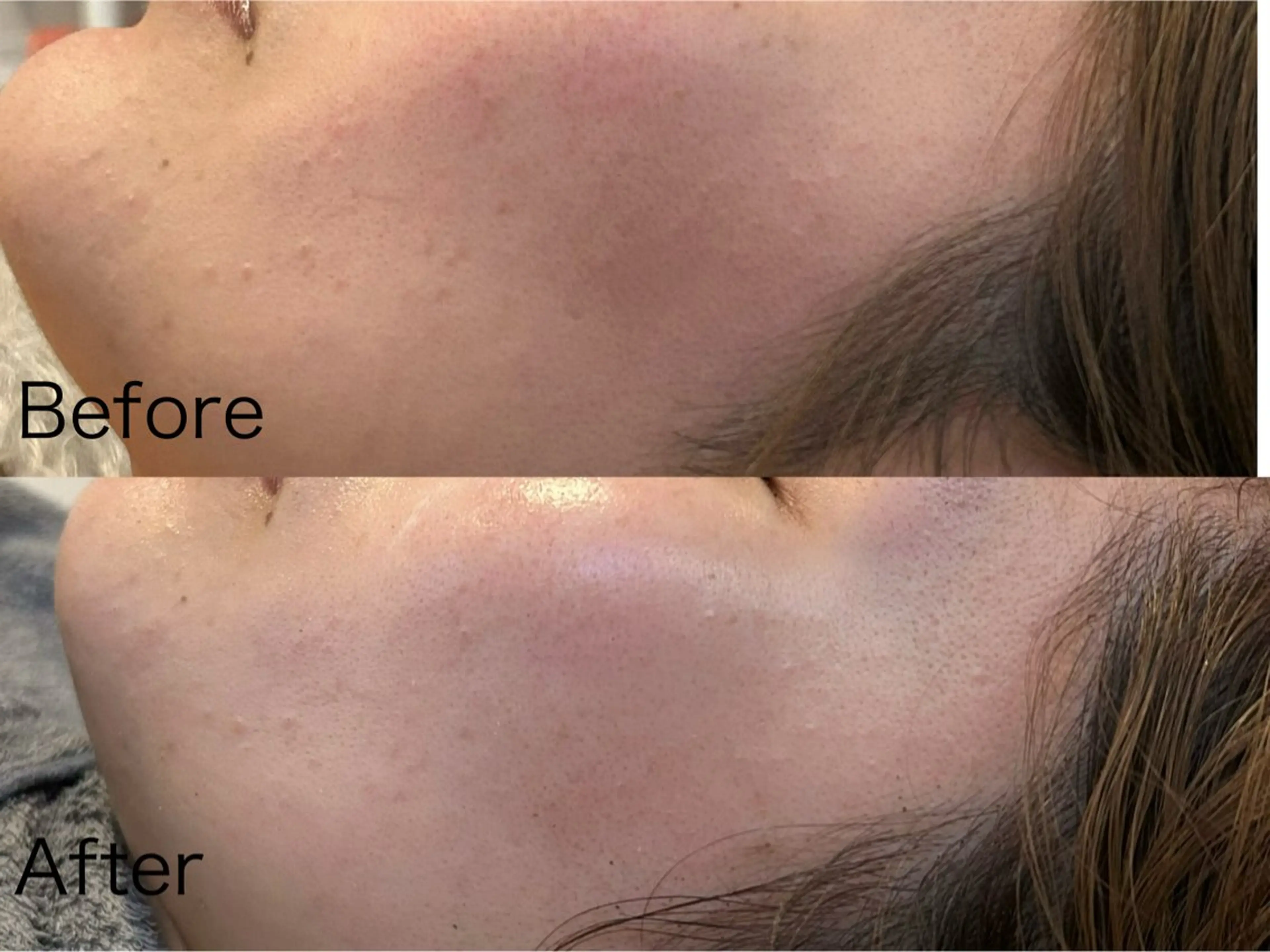 エステ Smoo アユミの眉毛・アイブロウイメージ