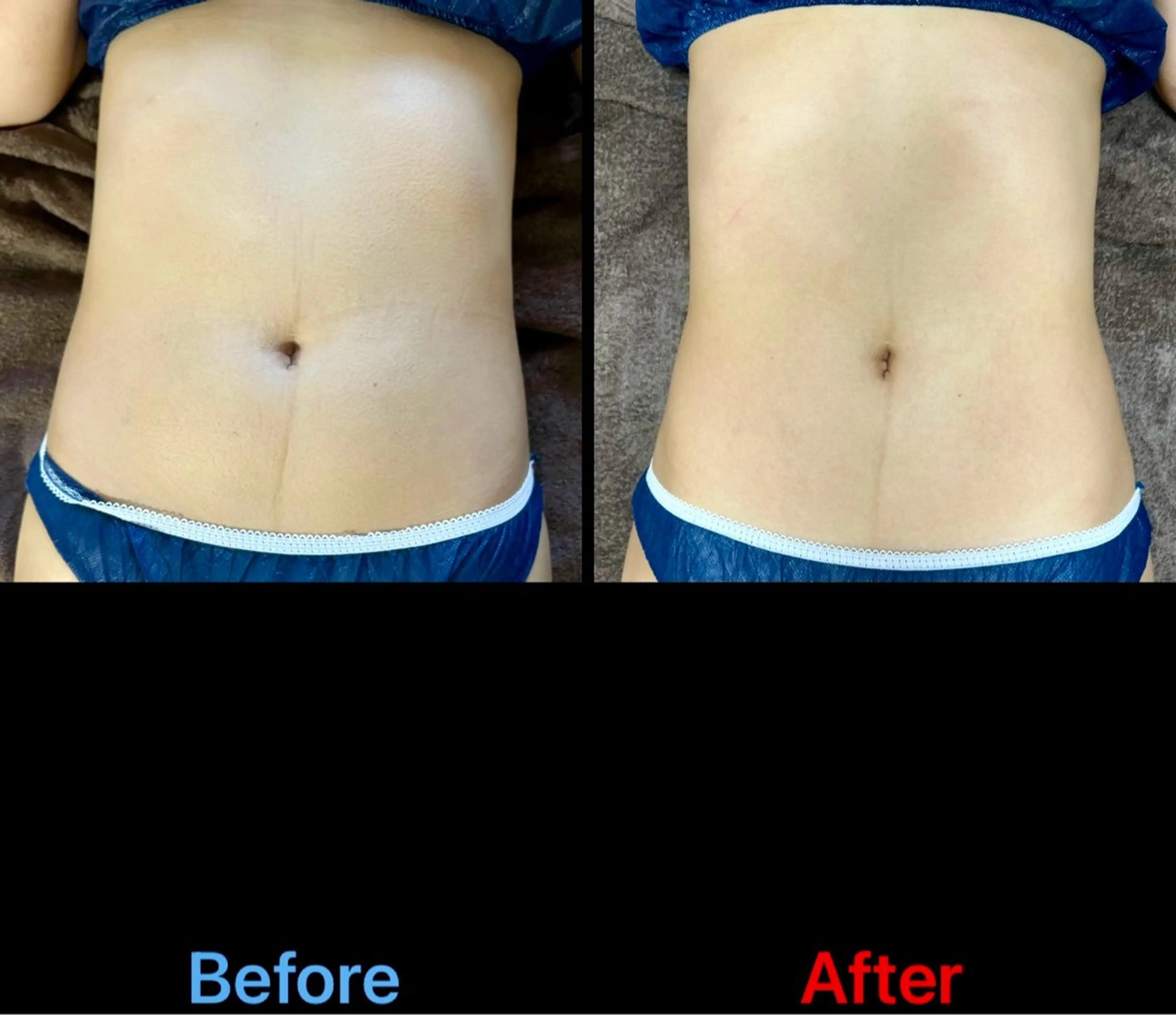 lumirise viblissのエステ・リラクイメージ