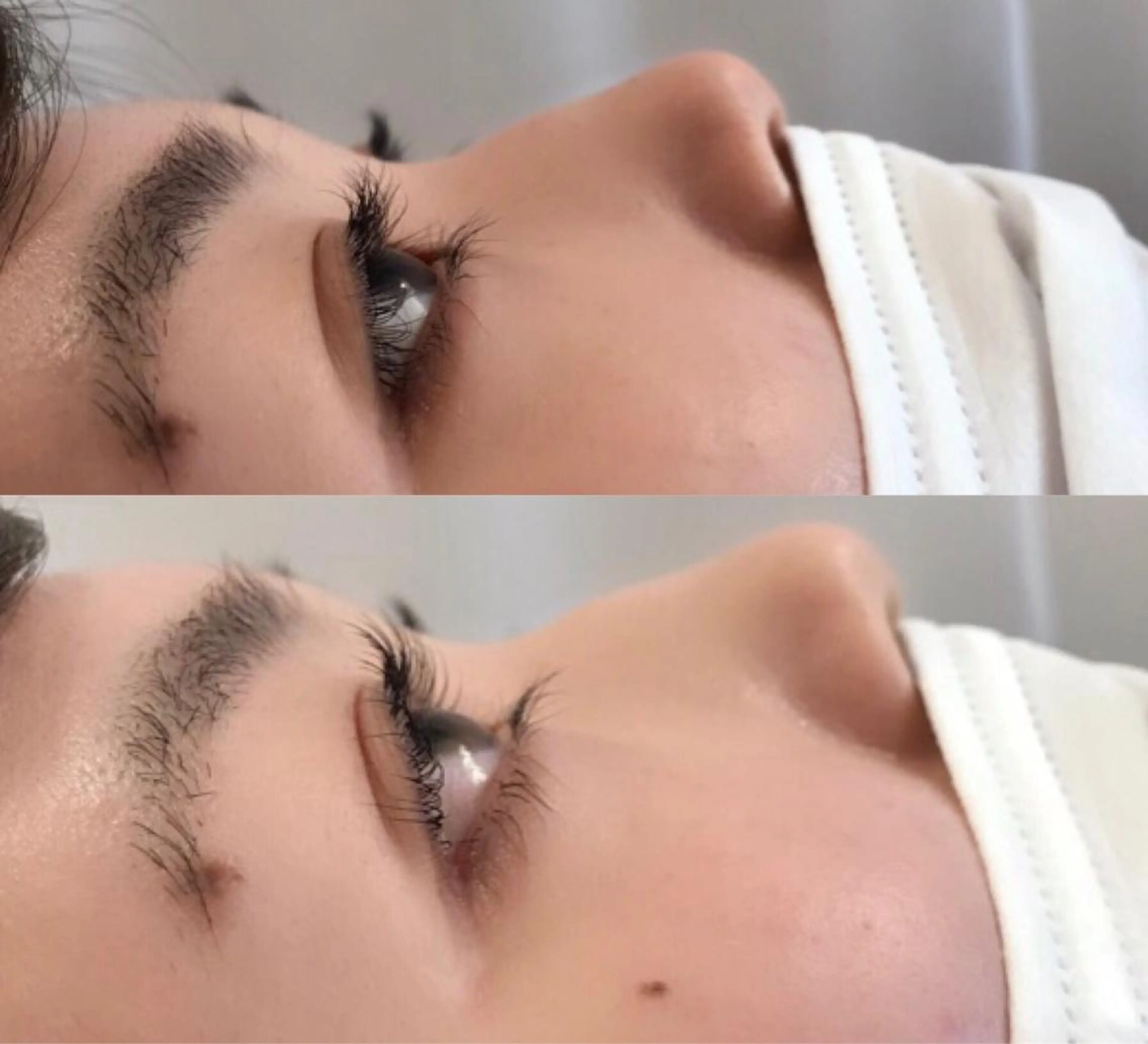 マツエク・マツパ まつげ、毛穴 TREEのエステ・リラクイメージ