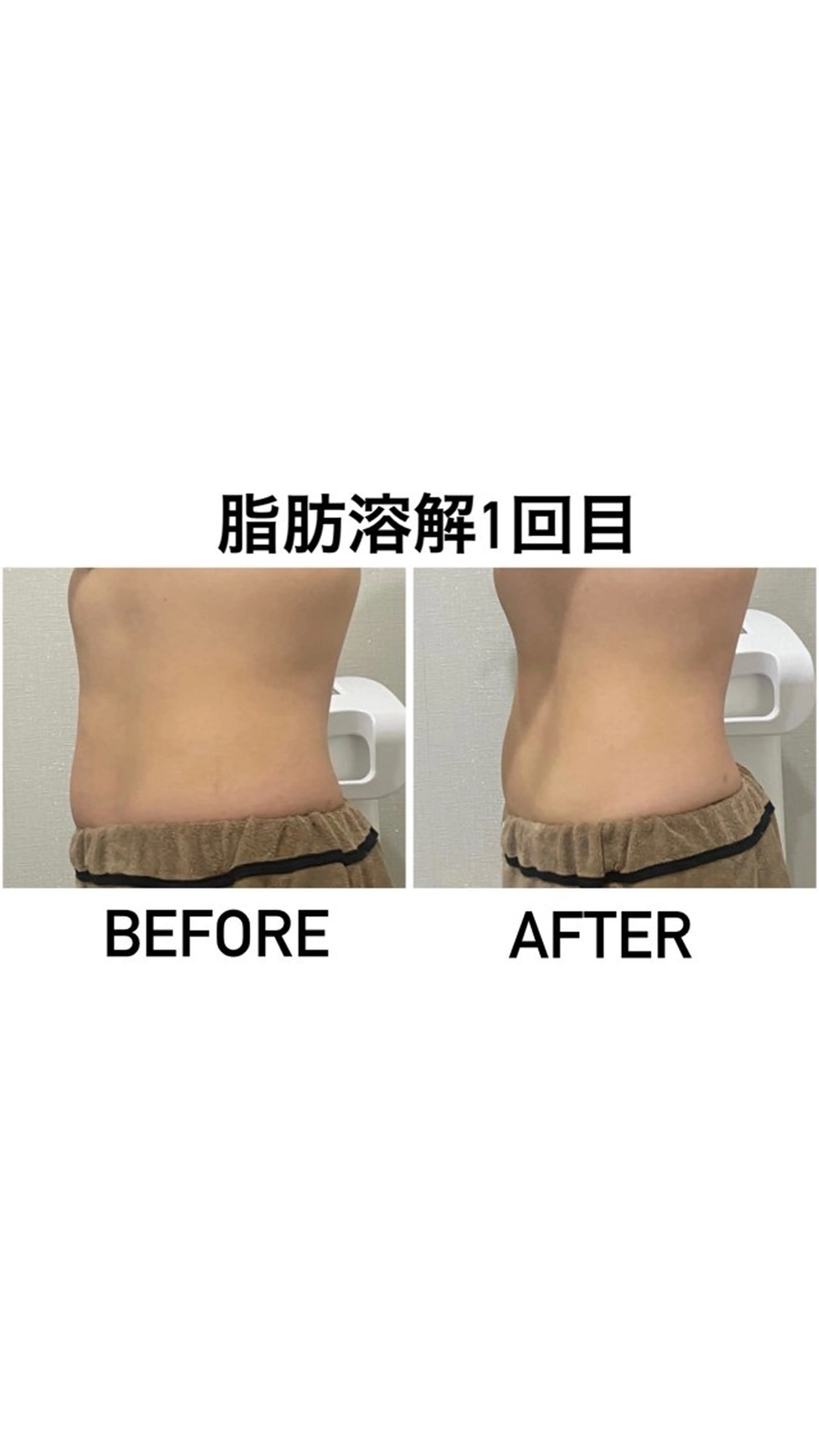 エステ アルカンジュ~archange~所属・痩身/毛穴洗浄/脱毛 アルカンジュのエステ・リラクイメージ