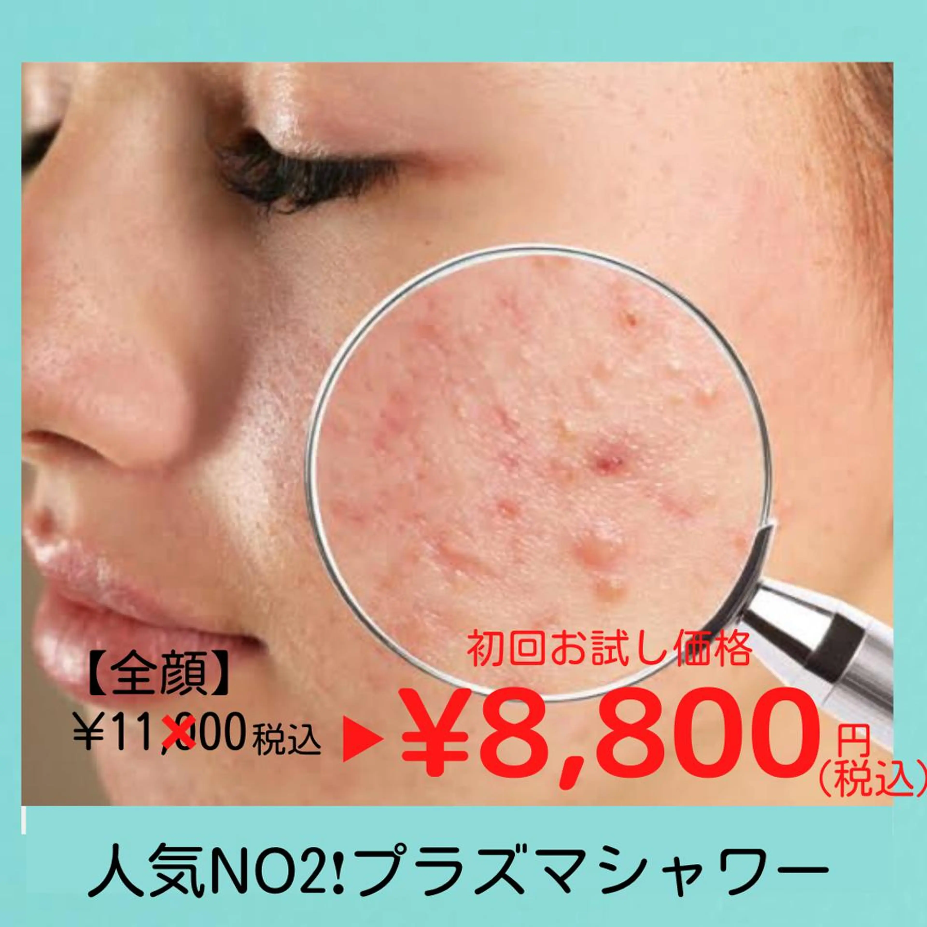 🌹憧れの陶器肌へ❗️プラズマシャワーの写真