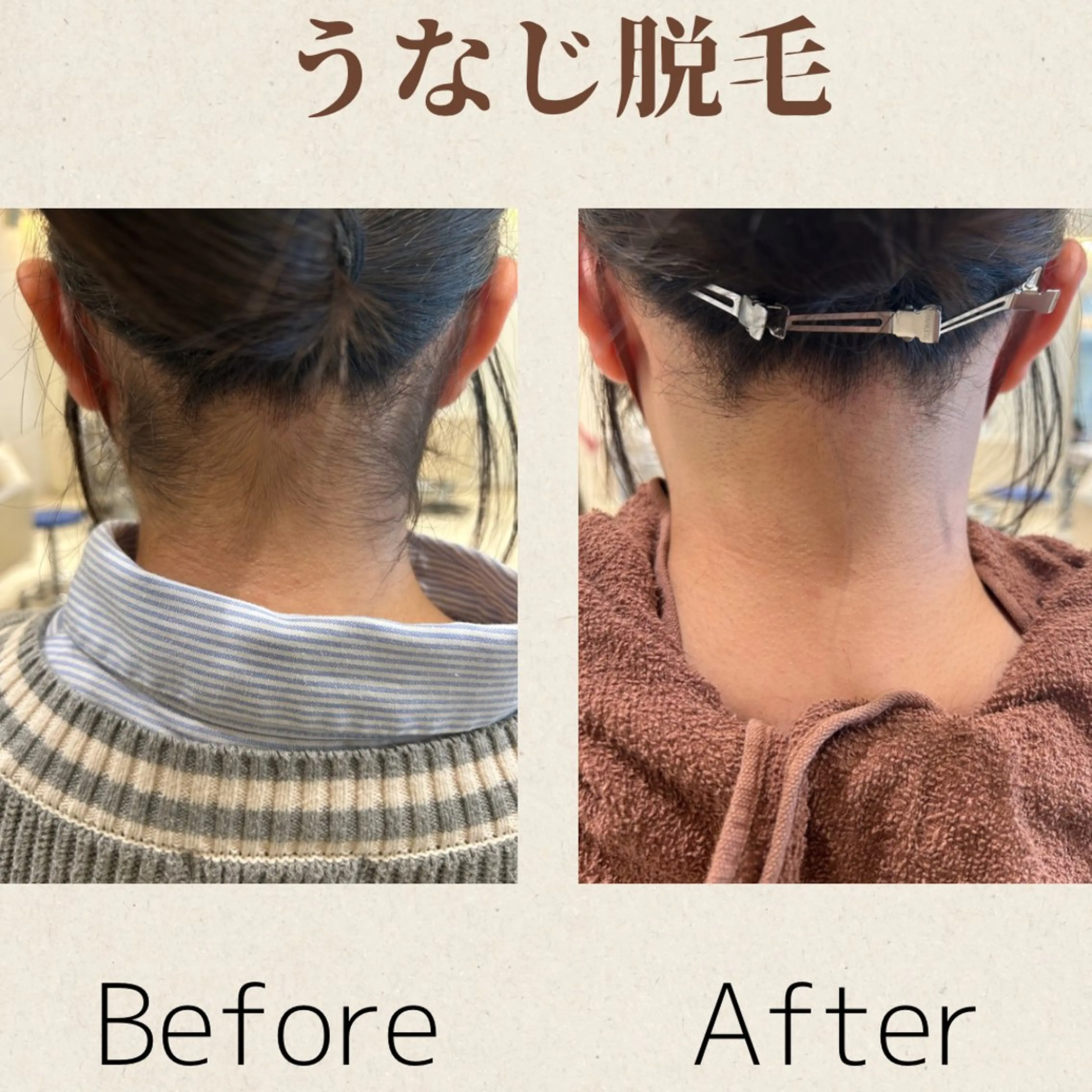 脱毛 MODE K's 白石彩夏のエステ・リラクイメージ